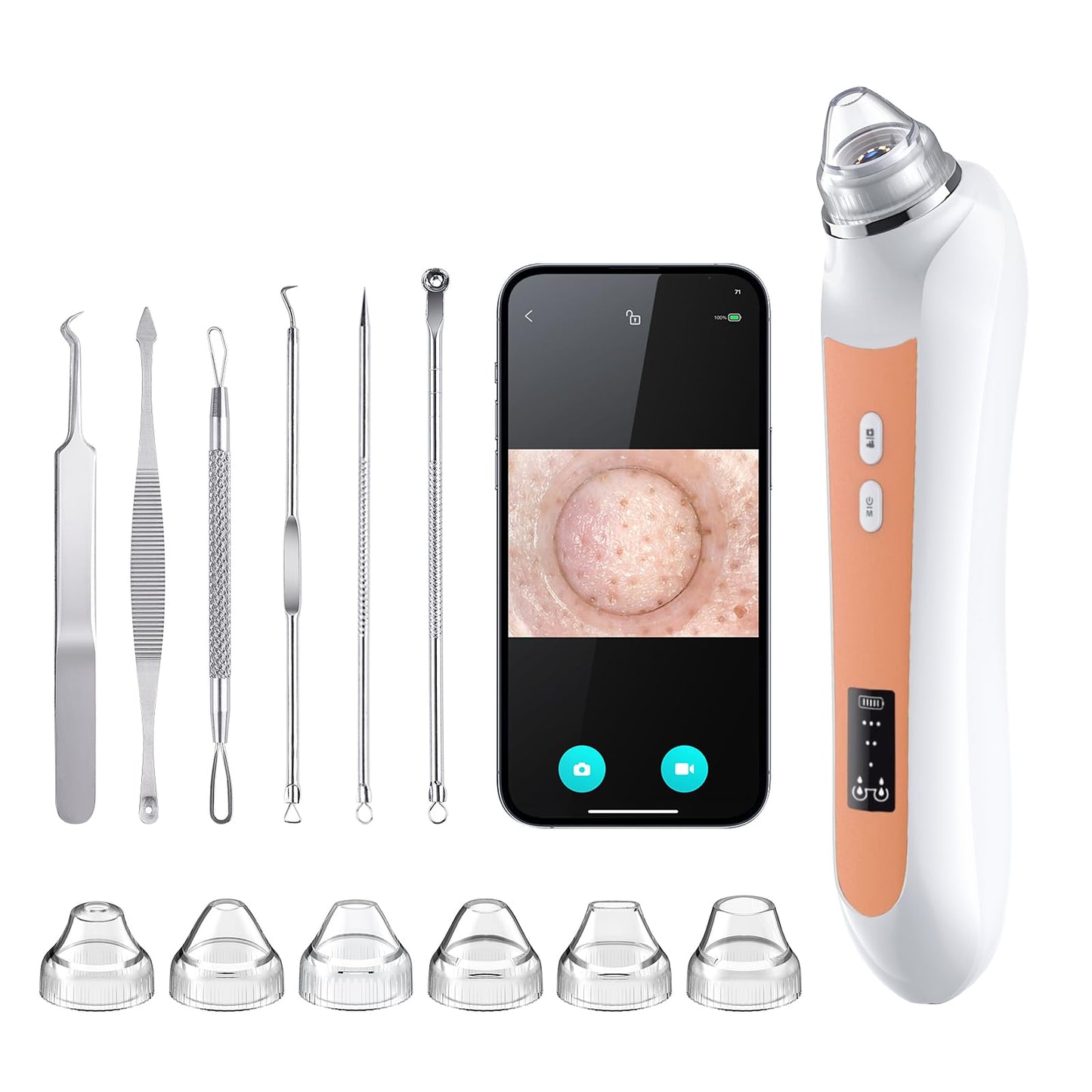 Facial Pore Blackhead Remover Vacuum, 1080P Camera Blackhead Remover, 20x Zoom, 8 LEDs & 3 Suction Modes, 800mAh Battery & USB -