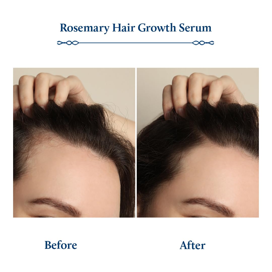Blue Nectar Hair Growth Serum with Rosemary Oil for Hair Growth | Ayurvedic Hair Tonic Spray (8 Herbs, 3.38 Fl Oz)