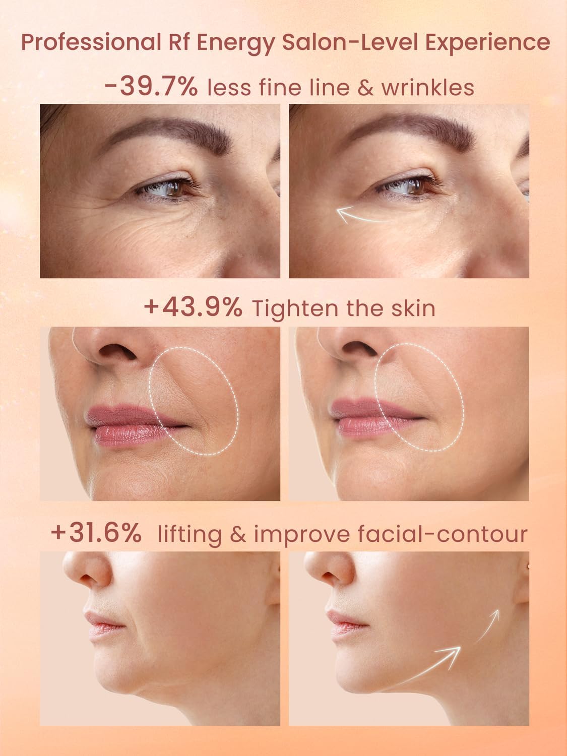 Radio Frequency Skin Tightening Device, Professional Wireless Home RF Face Machine for Anti-Aging, Wrinkle Reduction, Lifting, F