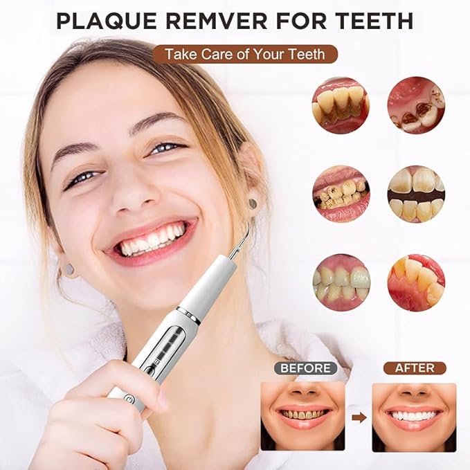 Plaque Remover for Teeth, Tartar Remover for Teeth, Rechargeable Electric Tartar Scraper with 3 Modes and Smart Protection, IPX7 Waterproof Dental Cleaning Kit with Tongue Cleaner (Black)