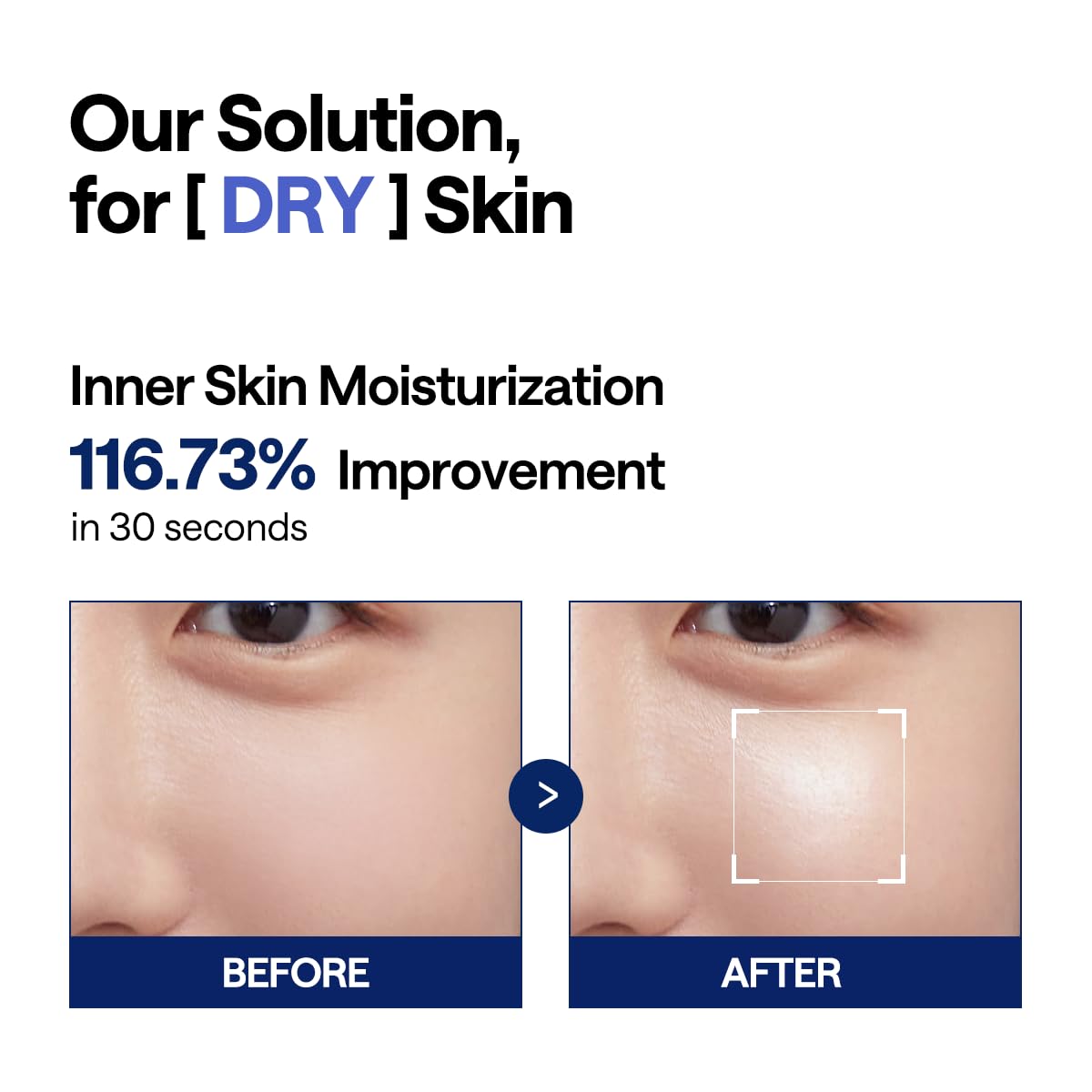 MEDIHEAL Watermide Moisture Pad - Square Cotton Facial Toner Pads with Icelandic Glacial Water - Improve Skin Temperature, Hydra