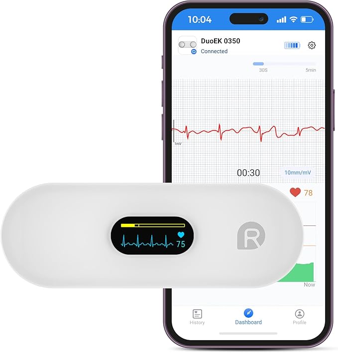 OVIIN Portable Heart Rate Monitor, Wireless Home Use Heart Rhythm Tracker, Heart Monitoring Devices,Smartphone App Compati...