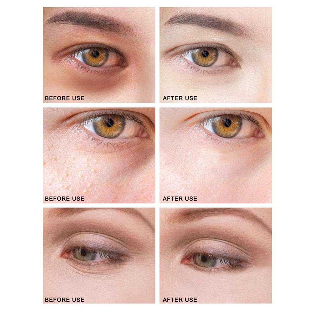 Golden Eye Cream Moisturizing Eye Serum Remove Dark Circles Fine Lines Eye Care Against Puffiness Eye Bags
