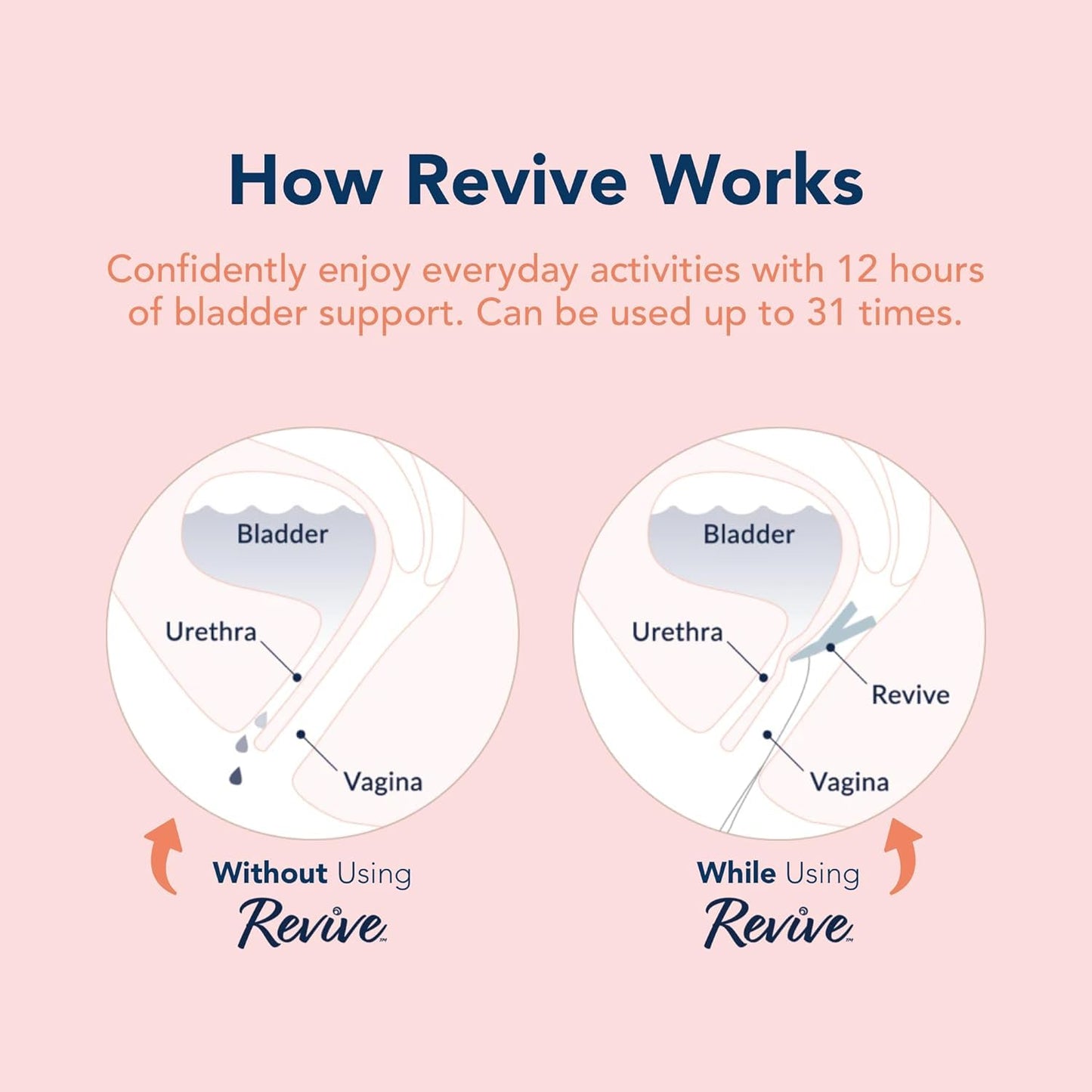 Revive Bladder Support Pessary for Women | Reusable Vaginal Device for Stress Incontinence & Leak Control | Comfortable Alternative to Pads & Liners | Womens Health Support | 1 Pack, One Month Supply
