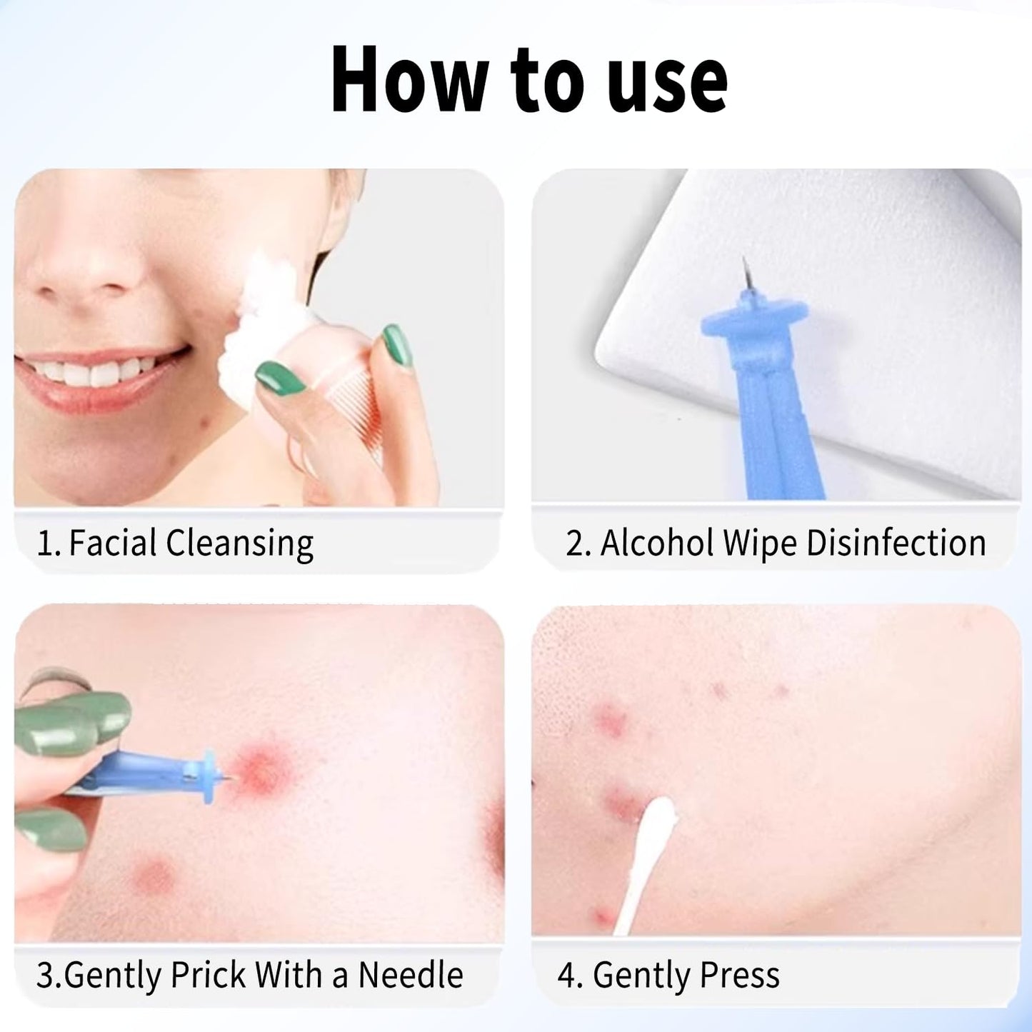 50 Pack Disposable Blackhead Remover Needles & Pimple Popper Tool Kit - Professional Acne Extractor Lancets for Whitehead, Comed