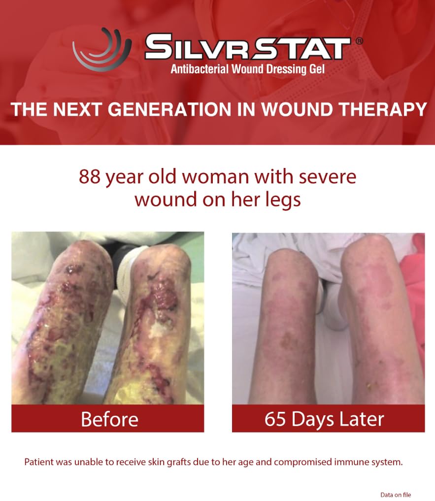 SilvrSTAT First Aid Kit Gel, 32 PPM Silver Healing Wound Dressing Gel, SilverSol Ag₄O₄ Particles, 1 oz