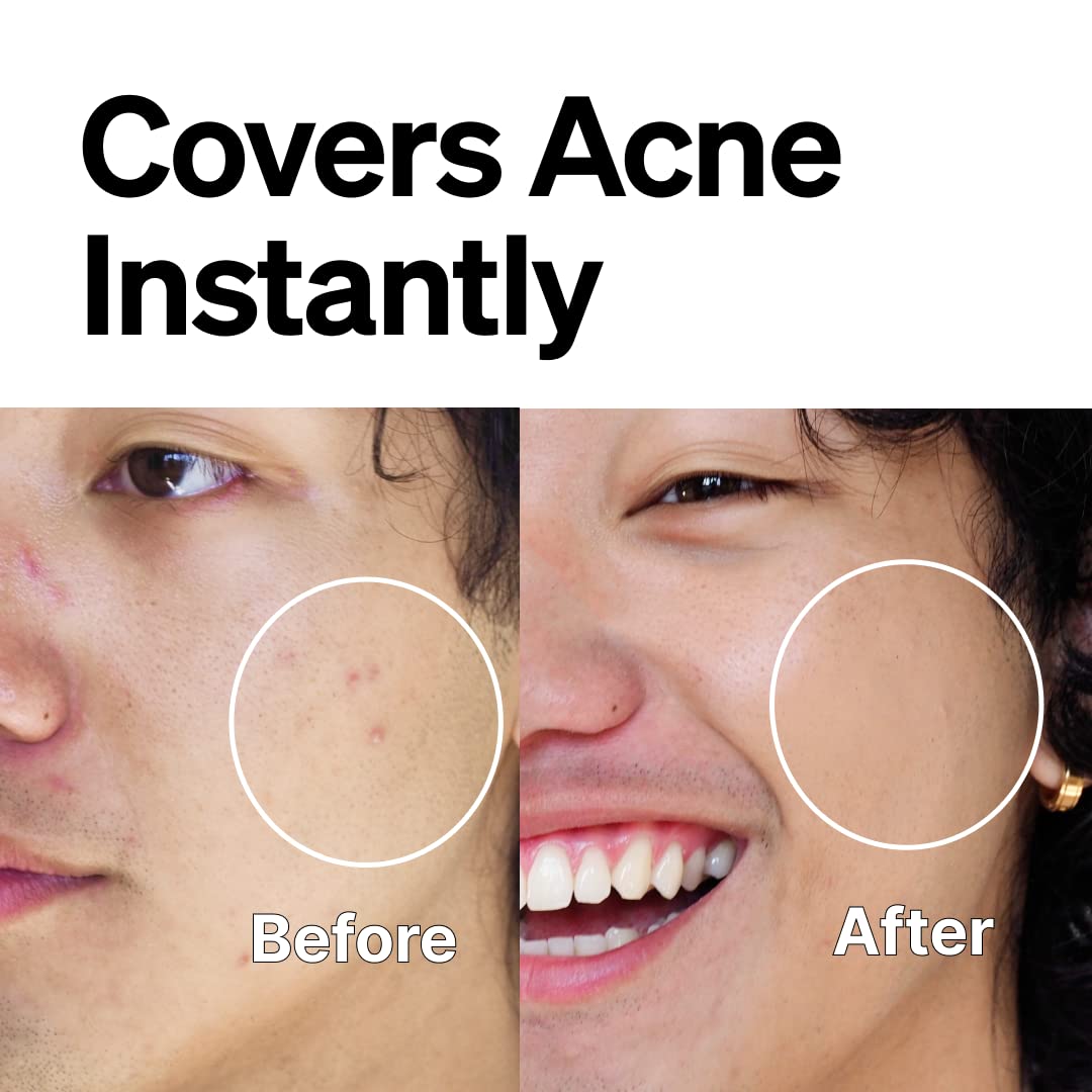 FRONTMAN Fade, Men's Acne Concealer With Salicylic Acid For Acne | For Blemishes & Dark Circles | Natural Coverage, Non-Greasy Formula, Oil-Free, Fragrance-Free | Perfect for All Skin Types | Men’s Concealer D2 Dark Shade