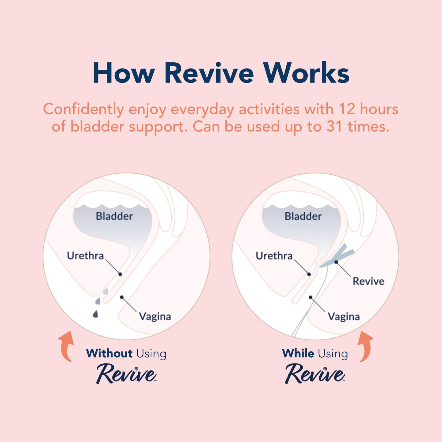 Revive Bladder Support Pessary for Women | Reusable Vaginal Device for Stress Incontinence & Leak Control | Comfortable Alternative to Pads & Liners | Womens Health Support | 2 Pack, Two Month Supply