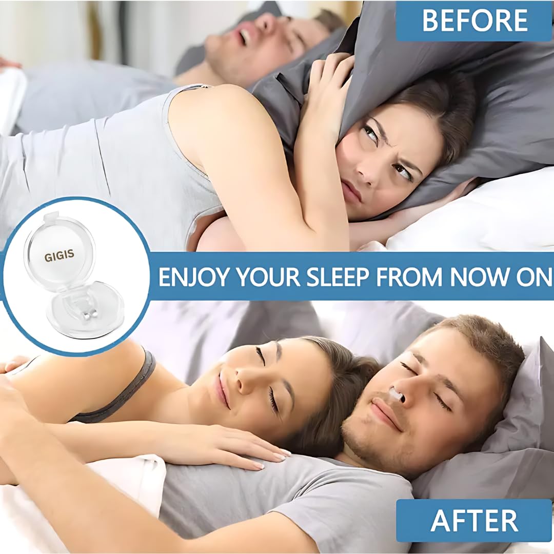 GIGIS No-Drip Severe Congestion 12 Hour Nasal Spray, 3x20mL Bundle Anti-Snoring Nose Clip & Nasal Strip (3 Items)