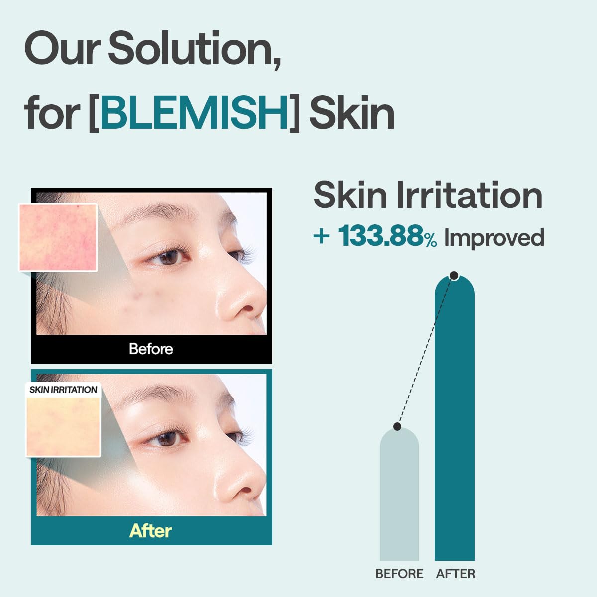 Mediheal Madecassoside Essential Sheet Mask Blemish Repair 4 pcs. 98% Purity Madecassoside & Hyaluronic Acid Included. Enhancing