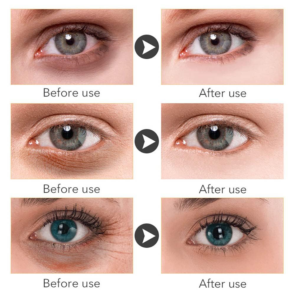 Magic Retinol Eye Cream for Dark Circles Puffiness and Bags Under Eyes, Instant Results Firm Eye Tightener Anti Aging Under Eye Cream for Men Women, Reduce Fine Lines Wrinkles and Age Spots, 1.06 Oz