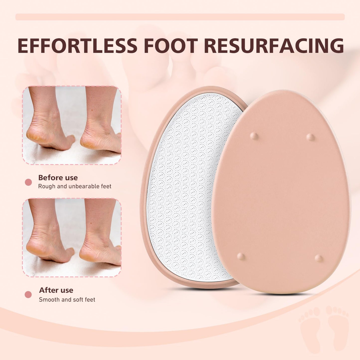 BALUCA Glass Foot File Callus Remover for Feet - Nano Glass Foot Scraper Scrubber Dead Skin Removal for Cracked Heels,Profession