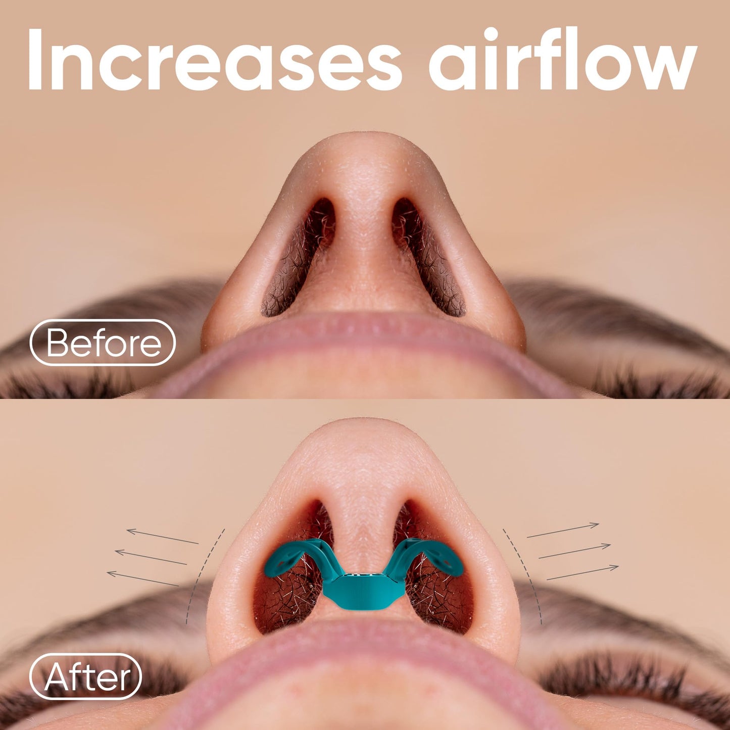 Brison Nasal Dilators for Breathing and Sleeping - 3 Pack Anti Snoring Nose Vents Opener for Better Breathing Sleep ing and Activity Improves Airflow - Soft