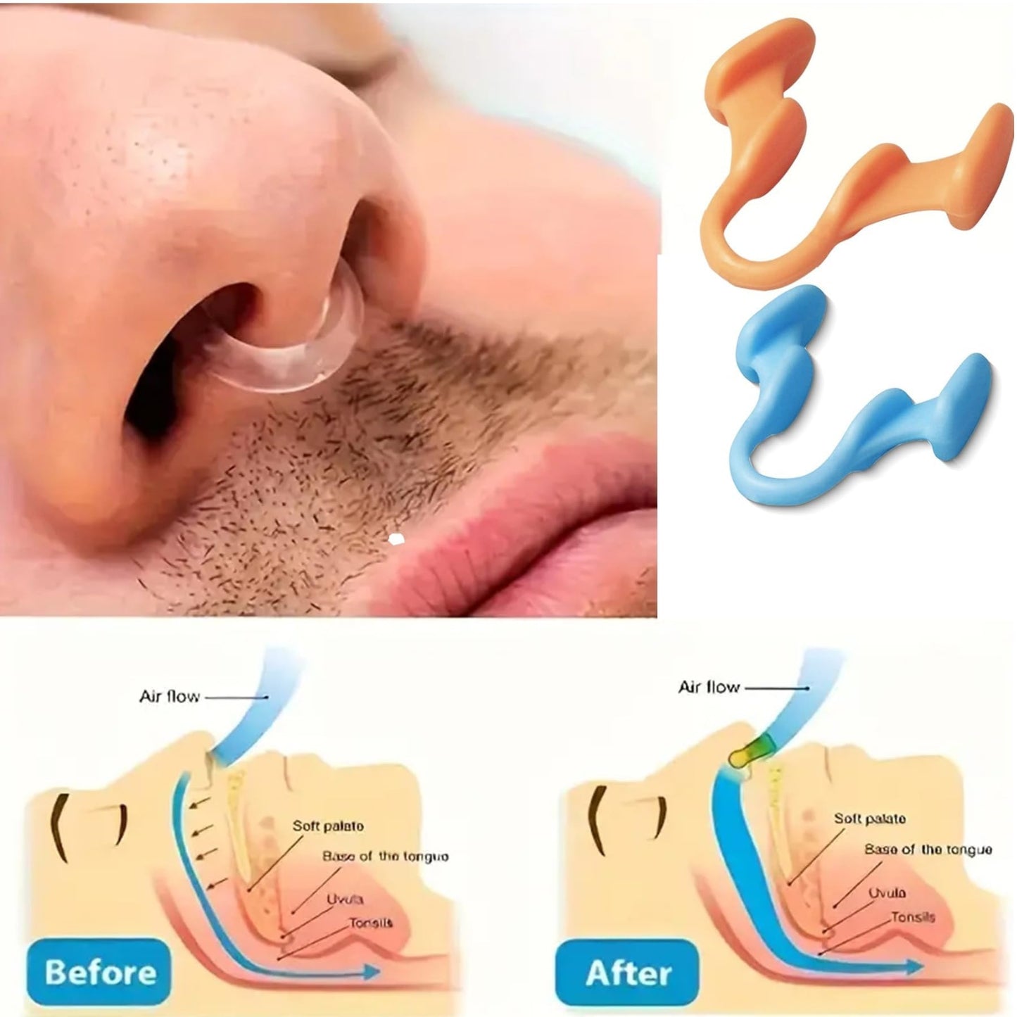 Nasal Dilator for Better Sleep Natural, Comfortable, Anti Snoring Device, Snoring Solution for Maximum Airflow and Easier Breathing 6 Pieces,Nasal dilators for Breathing
