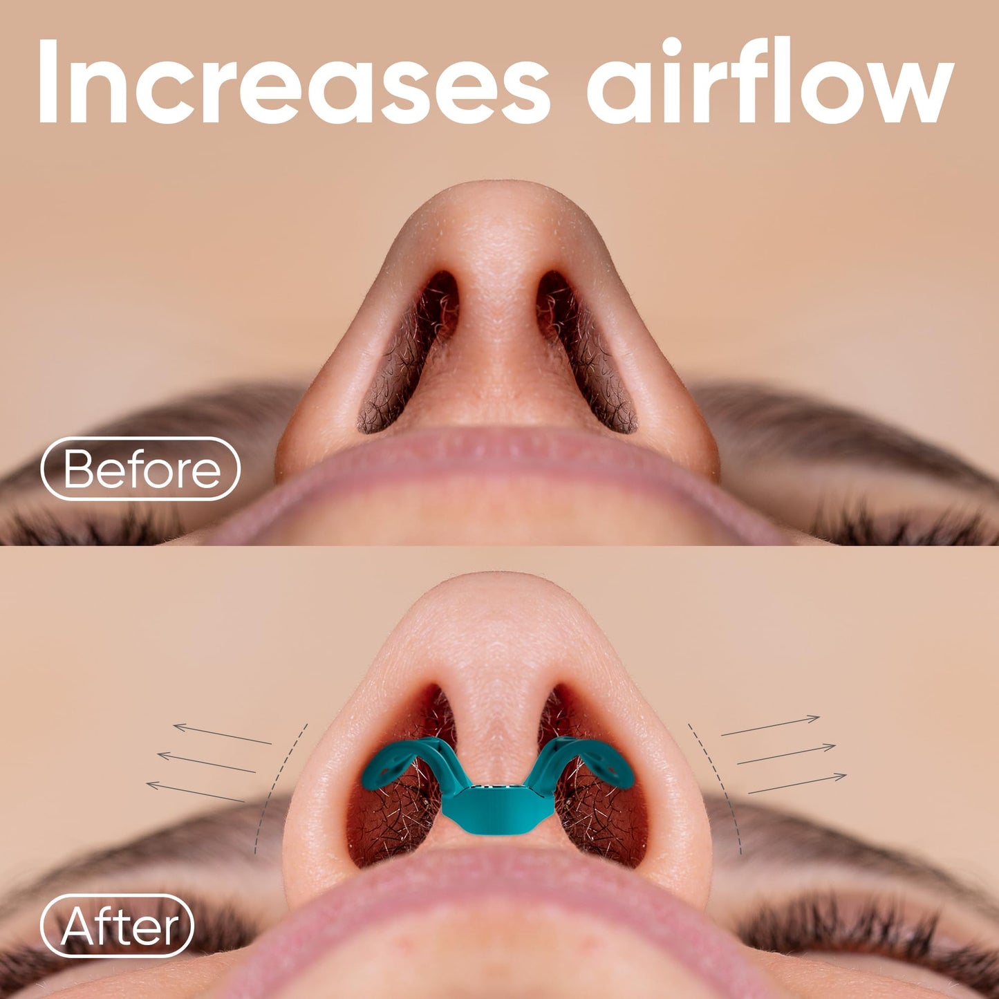 Brison Nasal Dilators for Breathing and Sleeping - 2 Pack Anti Snoring Nose Vents Opener for Better Breathing Sleeping and Activity Improves Airflow - 2pcs Soft-Hard