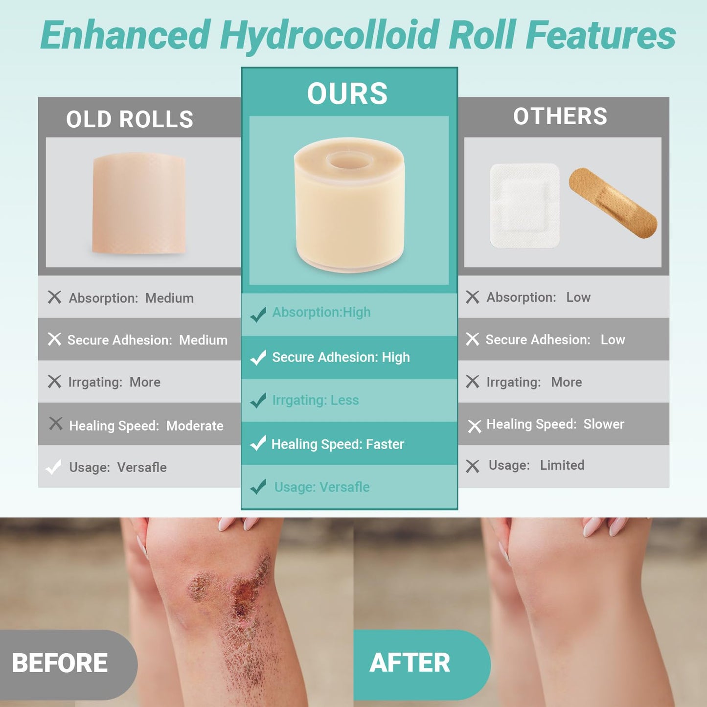Baojia Upgraded 2in*16ft Hydrocolloid Roll for Wound Care, Hydrocolloid Patch Large Bandages with Self-Adhesive, Ultra Absorbent, Flexible, Waterproof, DIY Size, First Aid Kit Essential
