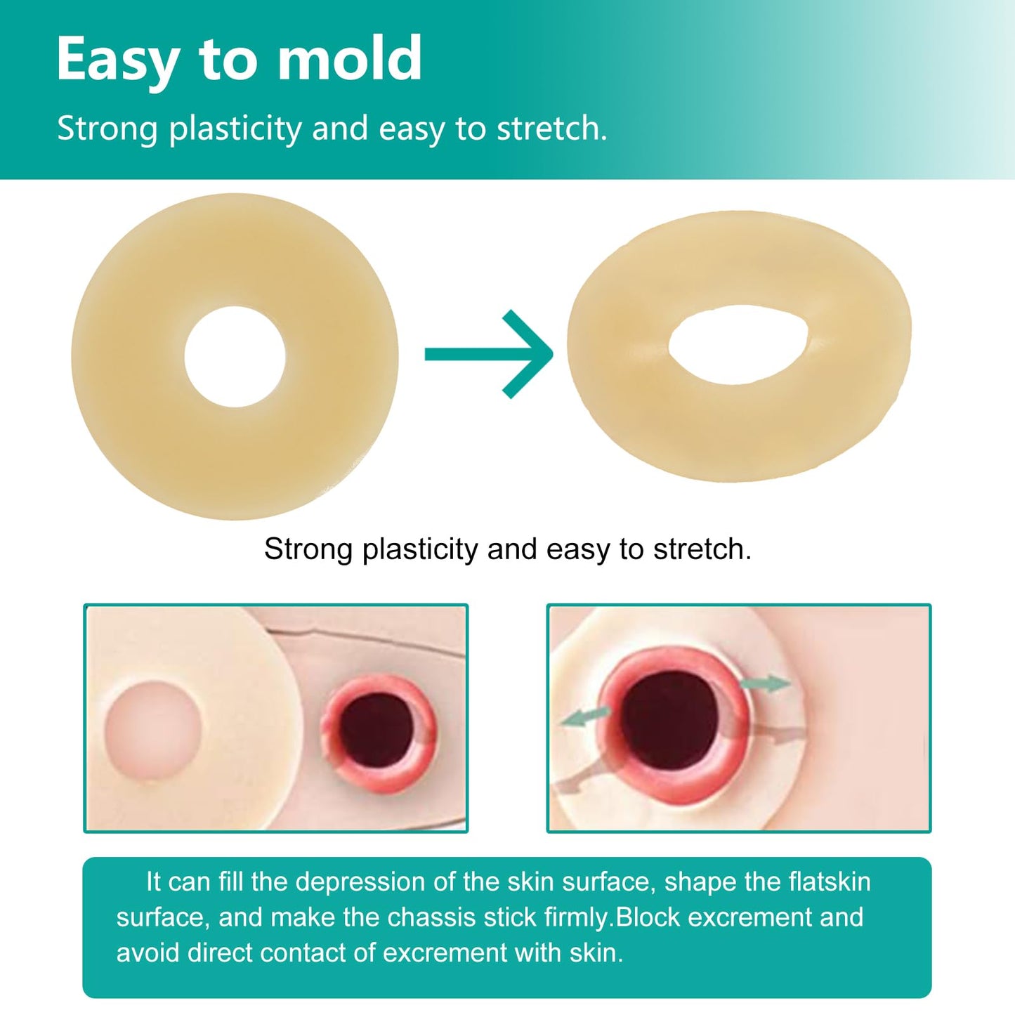 Ostomy Barrier Rings - Outer Diameter 2" (50mm) 2mm Thickness,Moldable Ostomy Rings,Hydrocolloid Skin Extender Rings for Colostomy Bags,10 Count