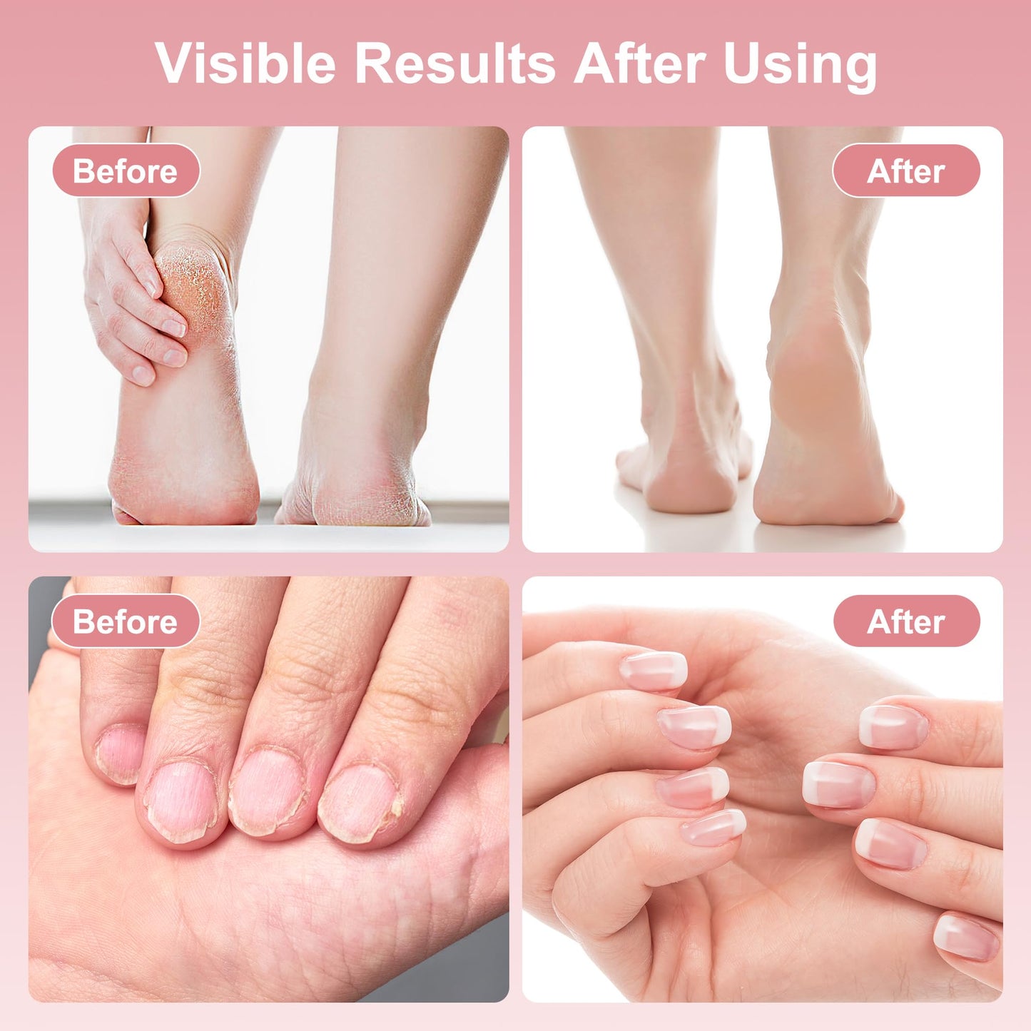 Electric Foot Callus Remover, 2 in 1 Rechargeable Foot File for Feet & Nails, 9 Speed Controller Callus Remover with Replaceable
