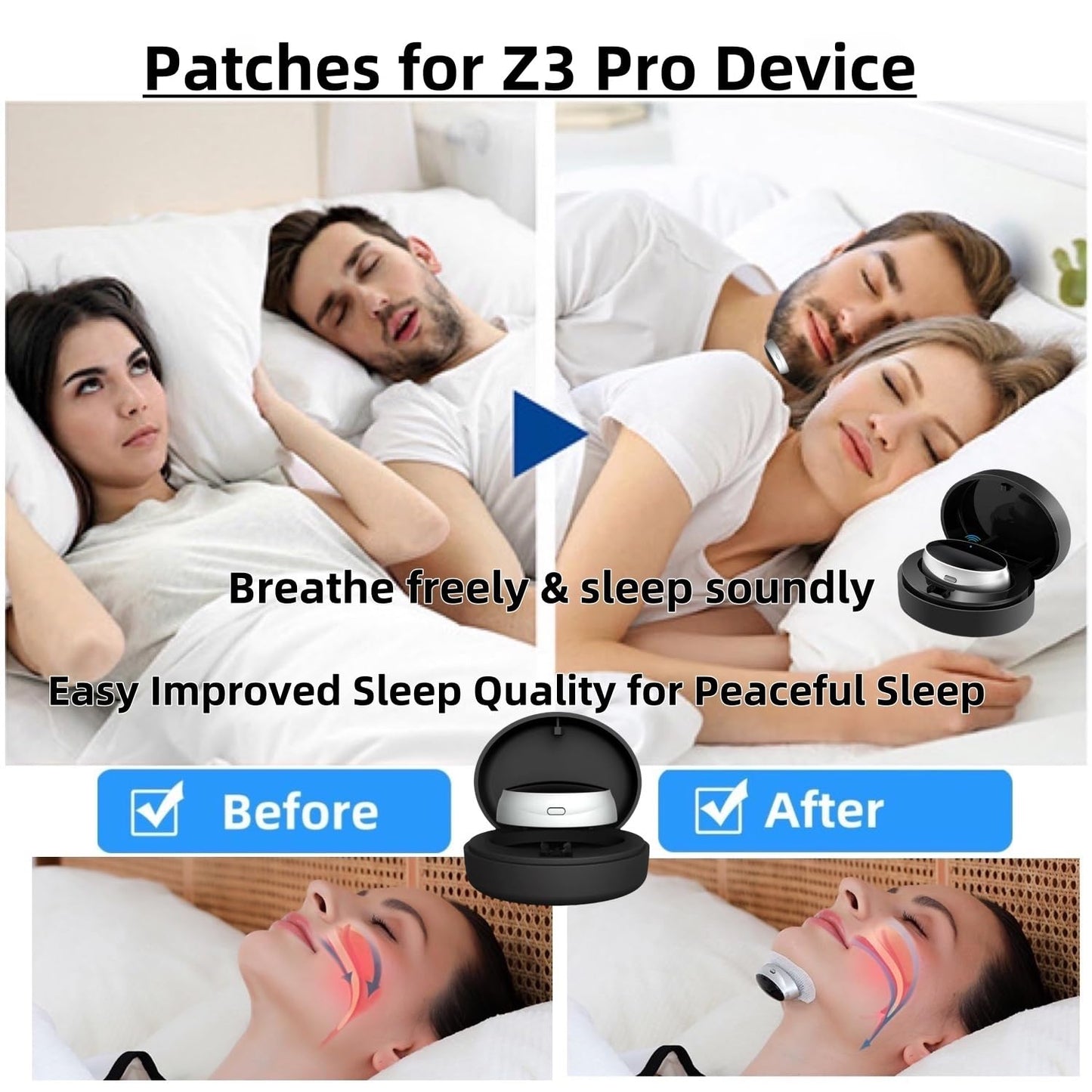 Z3 Pro Snoring Solution Patches,Professional Anti-Snoring Device Patches for Z3 Pro Anti-Snoring Device for Improved Sleep Soundly (1PC*20 Patches)