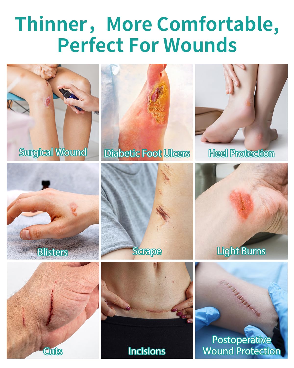 Upadated Hydrocolloid Bandages,12FT Hydrocolloid Roll for Wound Care,Medical-Grade Hydrocolloid Patch Bandages with Self-Adhesive, Flexible & Waterproof DIY Size & Shape (2in*12ft)