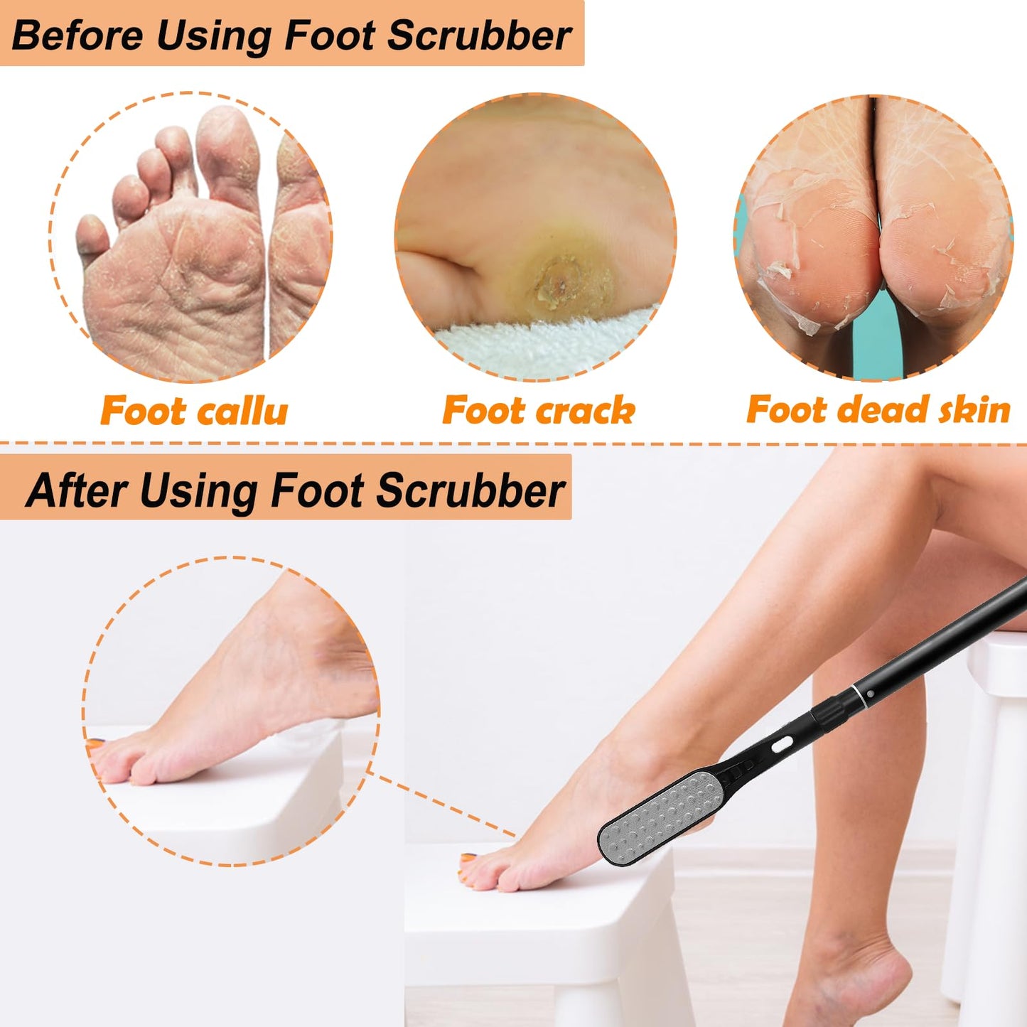 Gobiteli Toe Cleaning Brush Long Handle, 18.8 -25.9  Telescopic Long Handle Foot Scrubber Dead Skin Remover,Foot File for Feet C