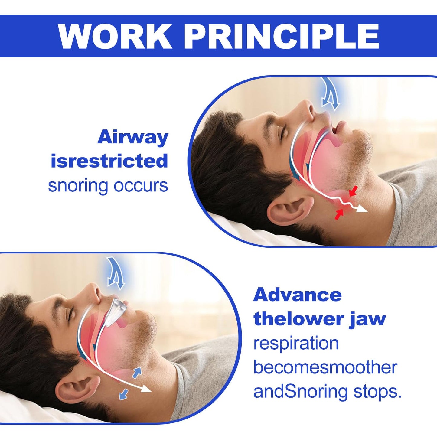 Anti-Snore Device — Reduce Snoring Aid forMen and Women