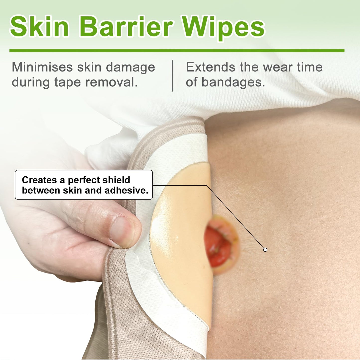 Carbou Skin Barrier Wipes - 100Pcs Skin Prep Wipes - Skin Adhesive Wipes to Create the Barrier Film Between Skin and Attachments, Ostomy Protective Wipes to Increase the Adhesive