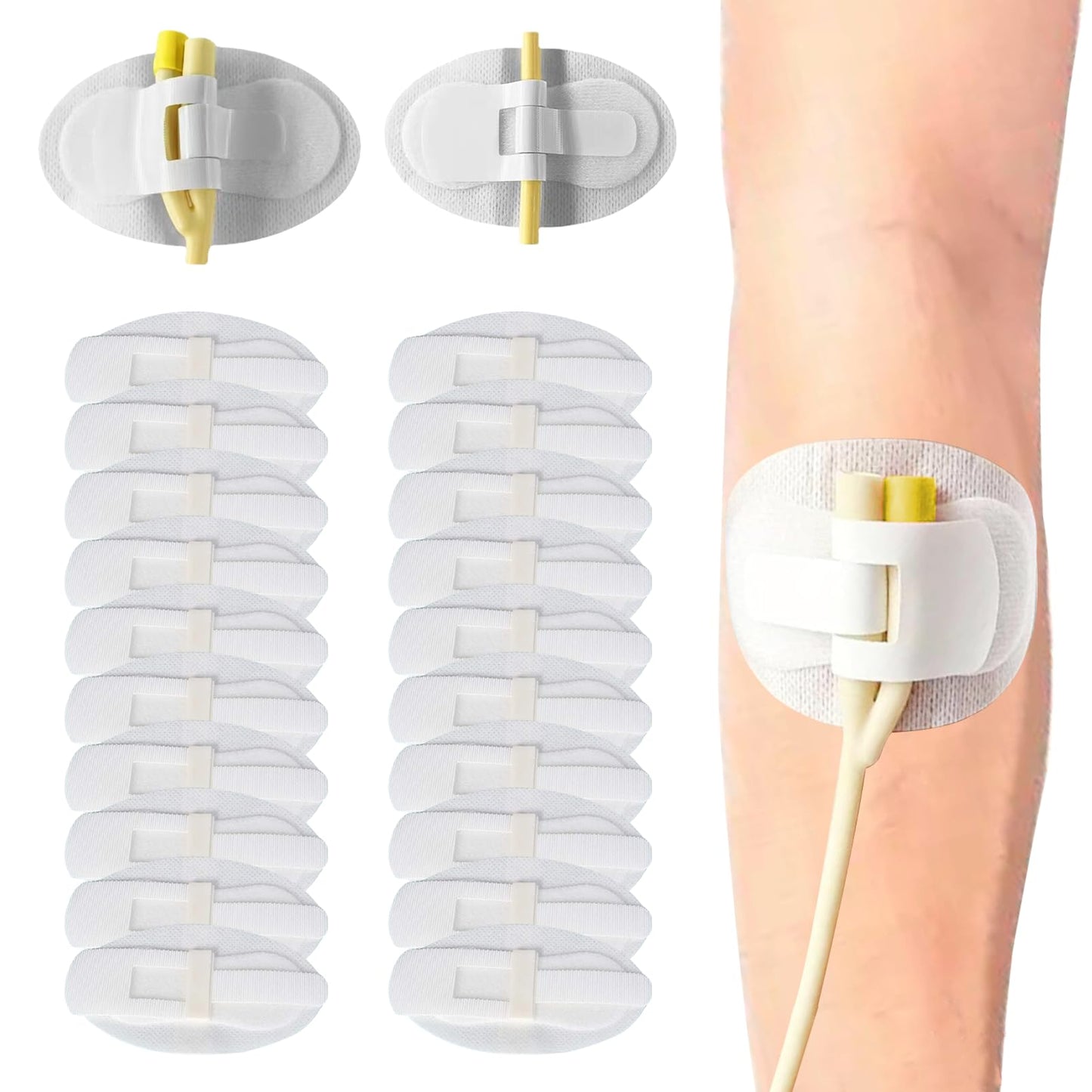 20Pcs Foley Catheter Stabilization Device, Catheter Tube Holder, Adhesive Catheter Urinary Leg Bag Legband Holder Catheter Supplies for Single/Double Tube, G Tube and Feeding Tube in Place