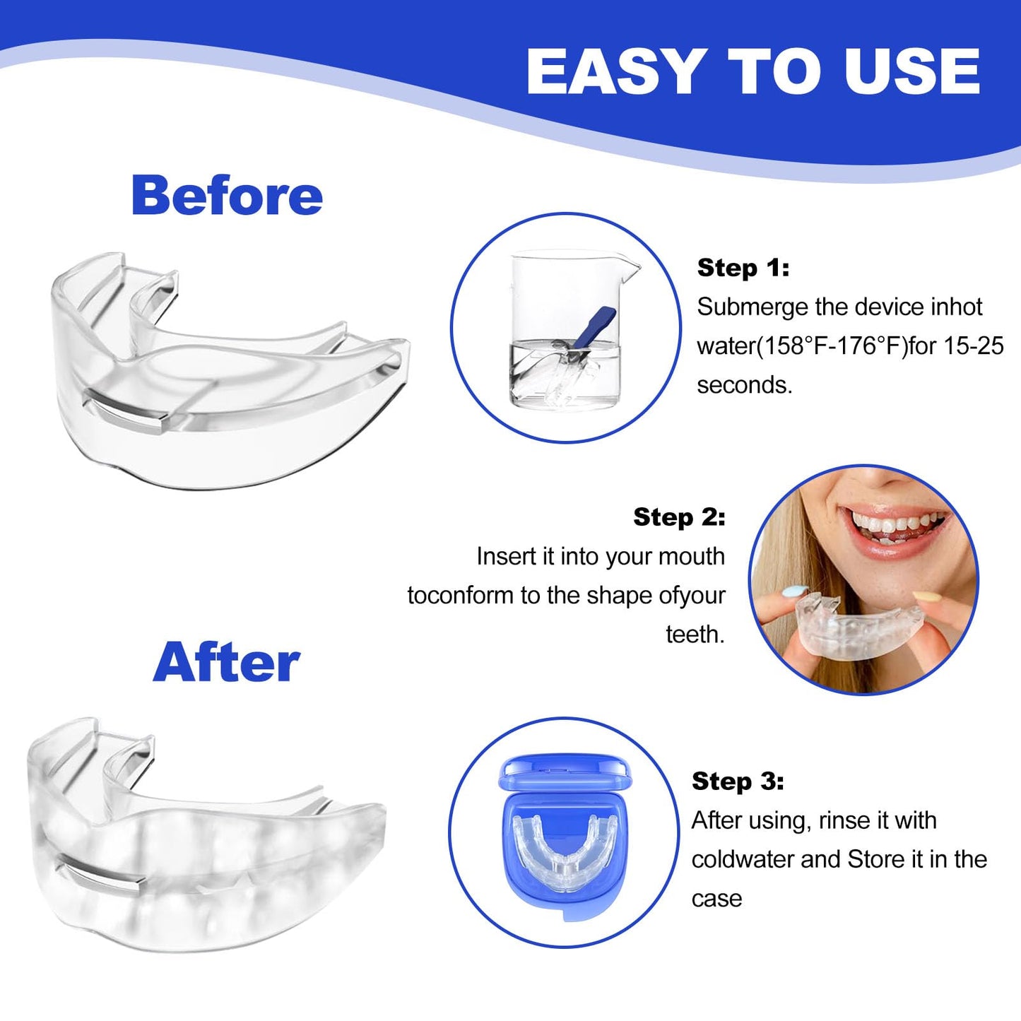 Anti-Snore Device — Reduce Snoring Aid for Men and Women