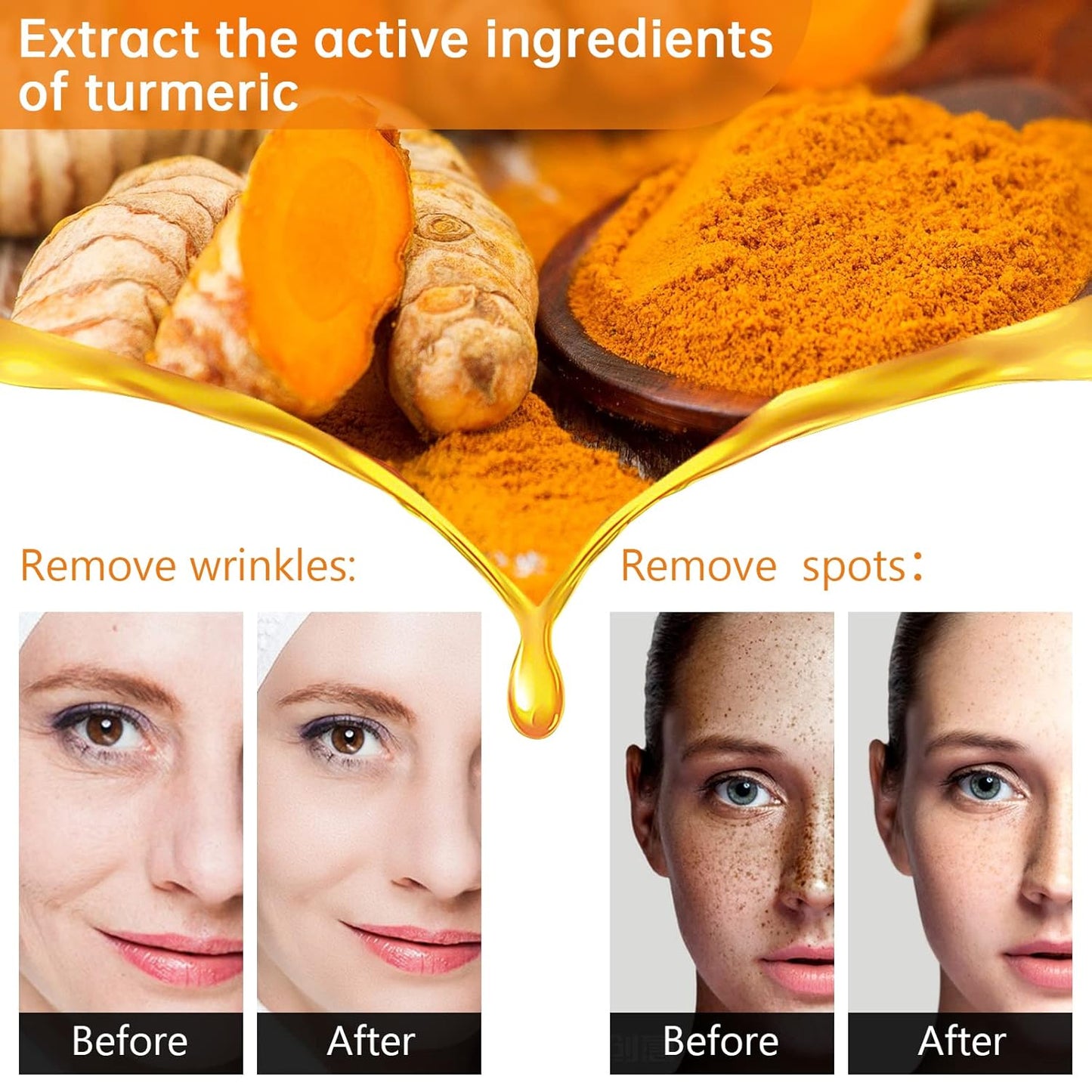 Turmeric Serum for Dark Spots 1 Fl Oz, Turmeric Dark Spot Corrector Serum for Face & Body, Anti Aging Facial Serum for Women and Men, Reduces Hyperpigmentation, Age Spots, Sun Spot, Improve Skin Tone
