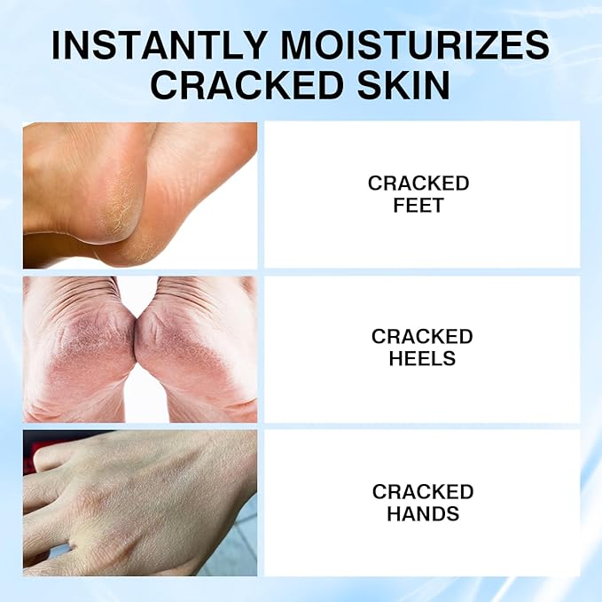 Foot Cream Stick for Dry Cracked Heels,Moisturizing Balm with Olive Oil,Roll-On Repair Treatment for Rough Feet, Hands & Elbows,No Mess Foot Lotion Alternative,1.05 oz,1 pack