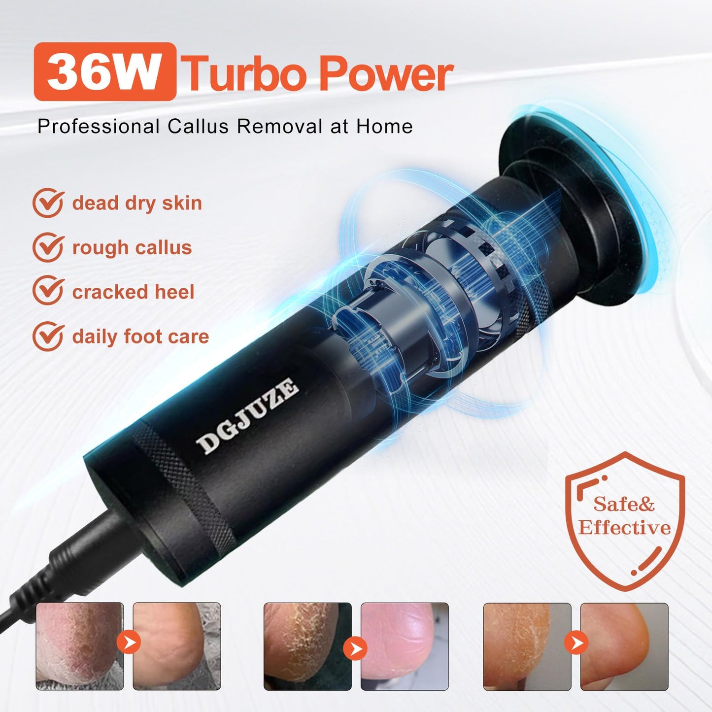DGJUZE PowerPro Electric Foot Callus Remover,36W Professional 1200rpm Heavy Duty Metal Grinder for Dead Skin Automatic Foot Sand