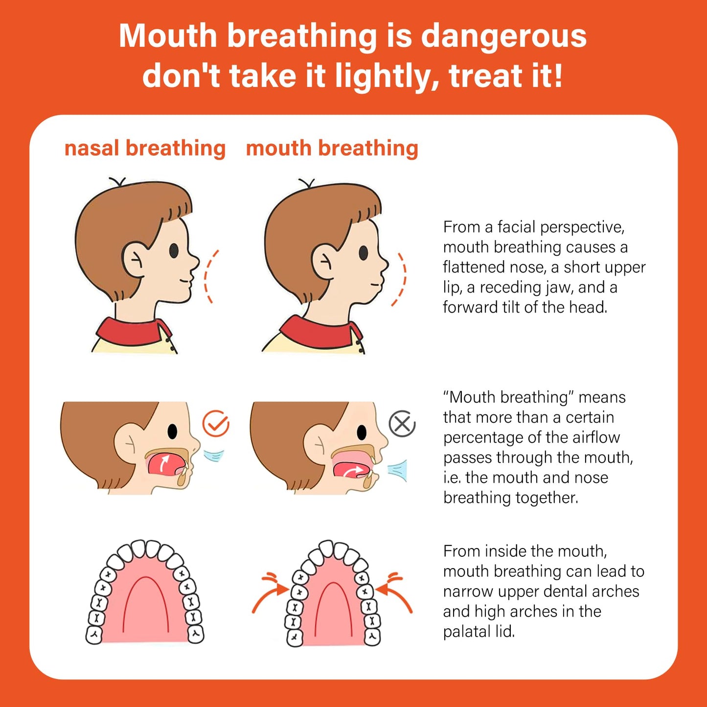 30pcs Mouth Breathing Correction Patch, Children's Closed Mouth Patch, Adult Anti-snoring, Closed Mouth Patch, Improve Mouth Breathing Facial Problems (Purple, 30pcs-Ages 3-7)