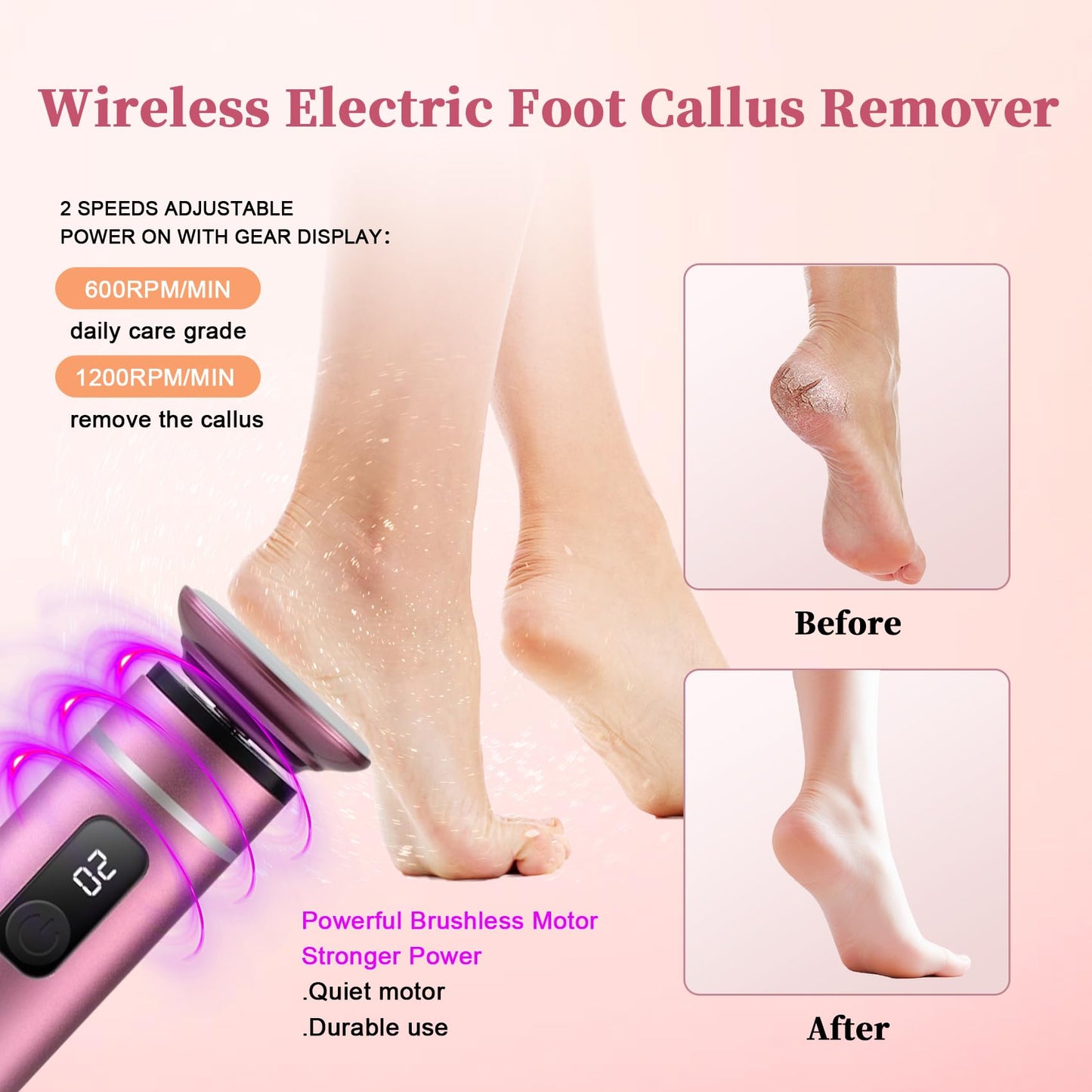 Electric Foot Callus Remover for Feet Pedicure Tools for Feet Callus Remover Foot File Electric Foot Callus Remover Pedicure Too