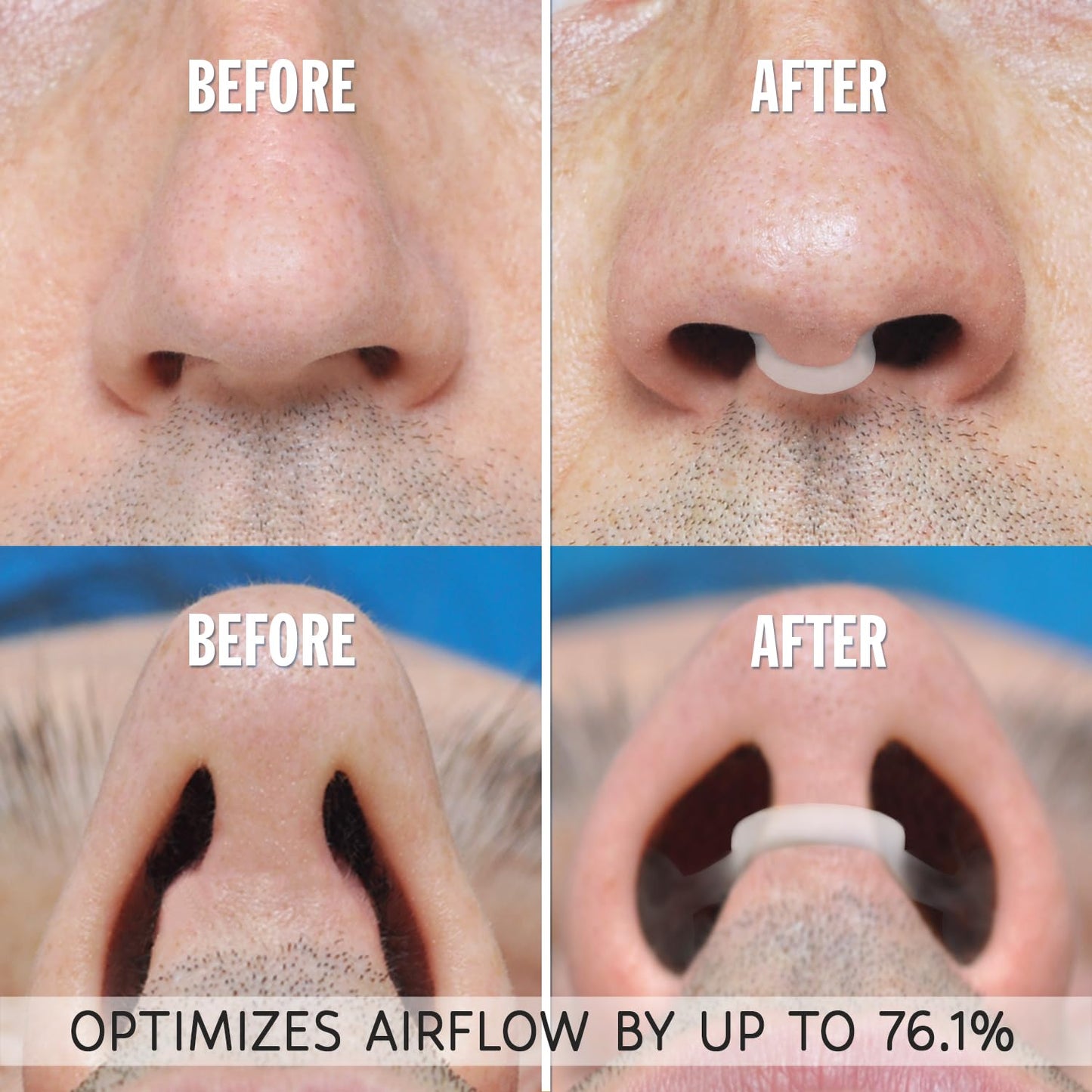 AIRMAX Nasal Dilator for Better Sleep - Natural, Comfortable, Anti Snoring Device, Snoring Solution for Maximum Airflow and Easier Breathing 2 Size Trial Pack (Small and Medium - Clear)