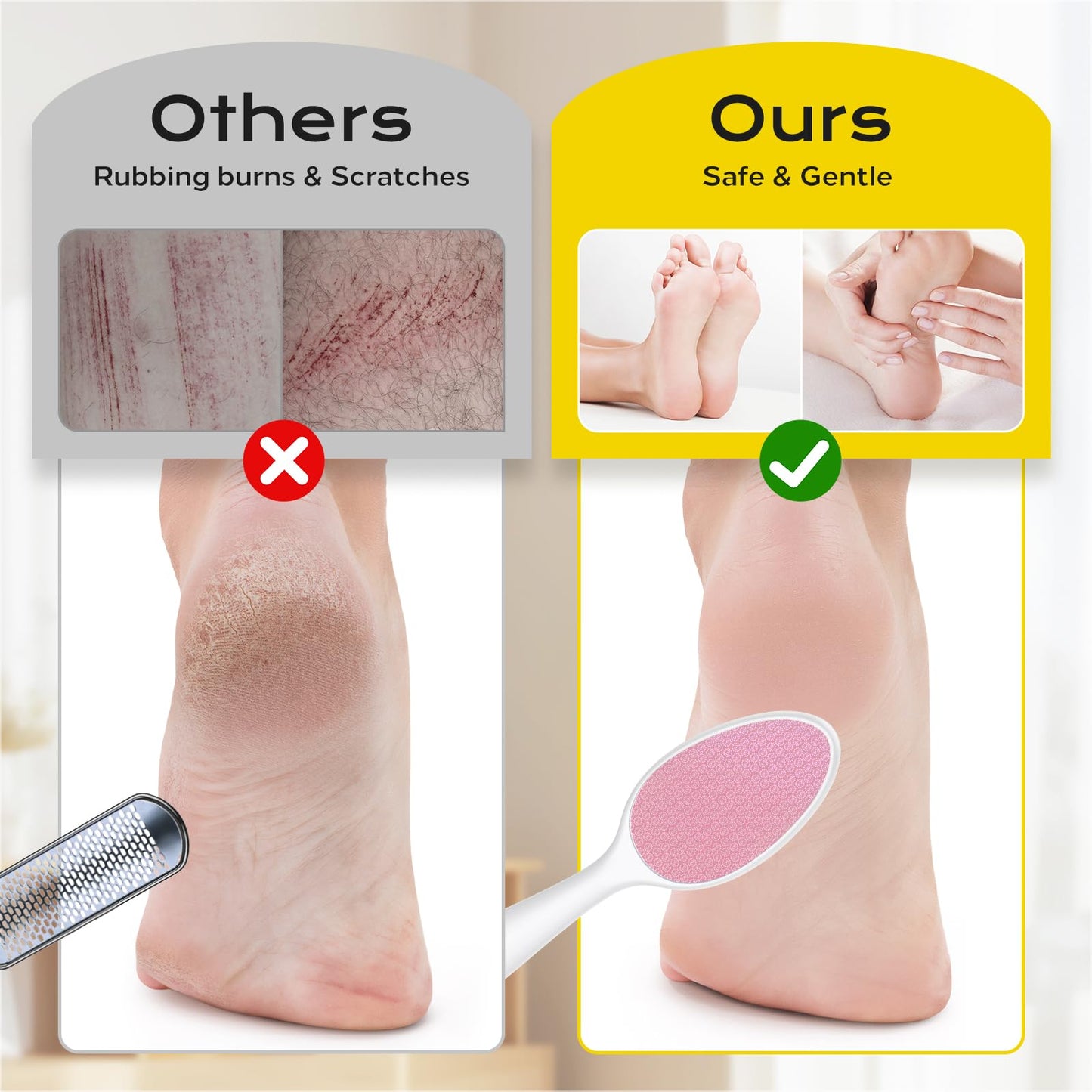 yomanta Foot File, Nano Glass Foot File Callus Remover with Handle, 2-in-1 Foot Scrubber Dead Skin Remover, Gentle Exfoliation F