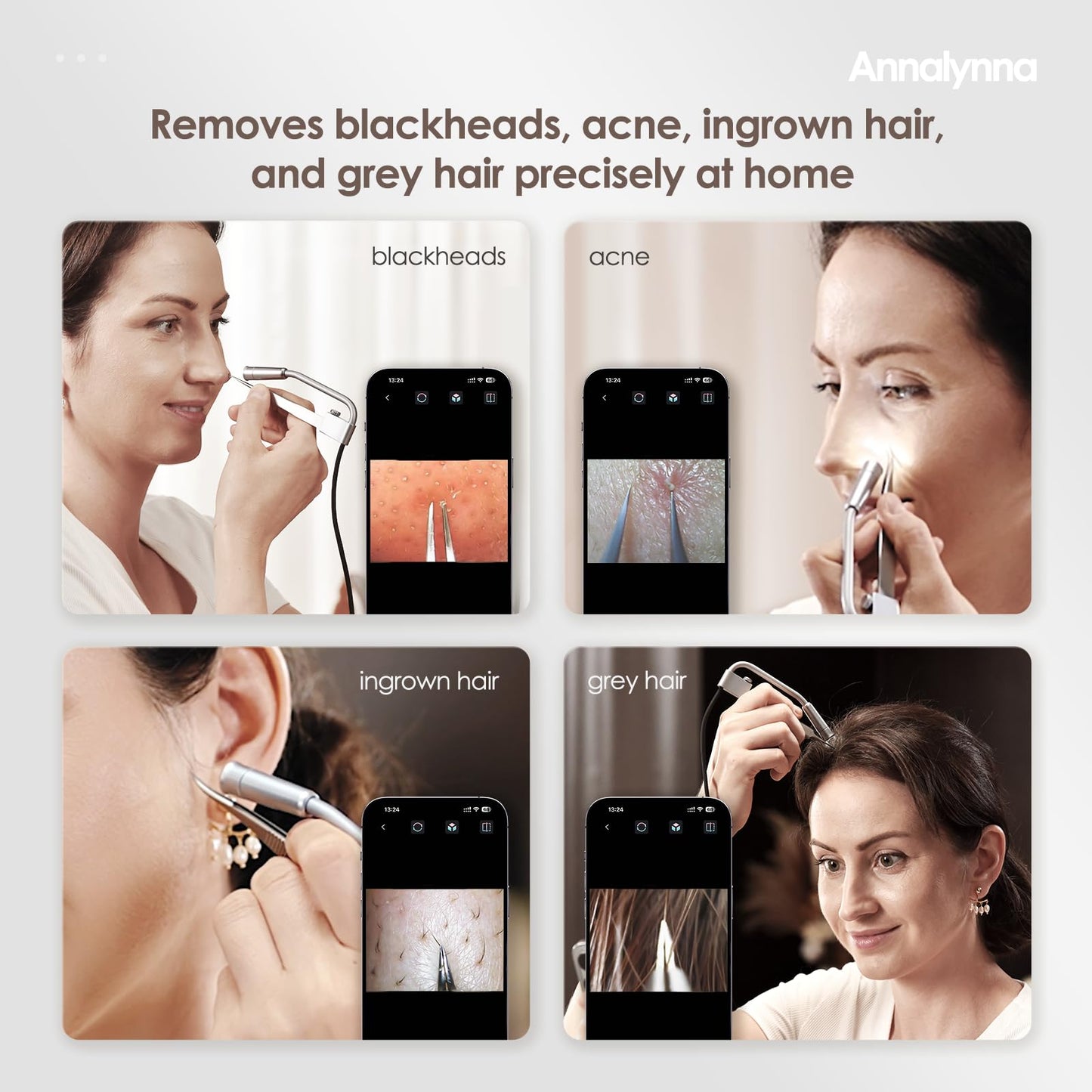 Luma 1 Visual Black Head Remover Tweezers with Camera - Pimple Popper Tweezers with Camera 20x Magnification, 1080P, 8 LED Light