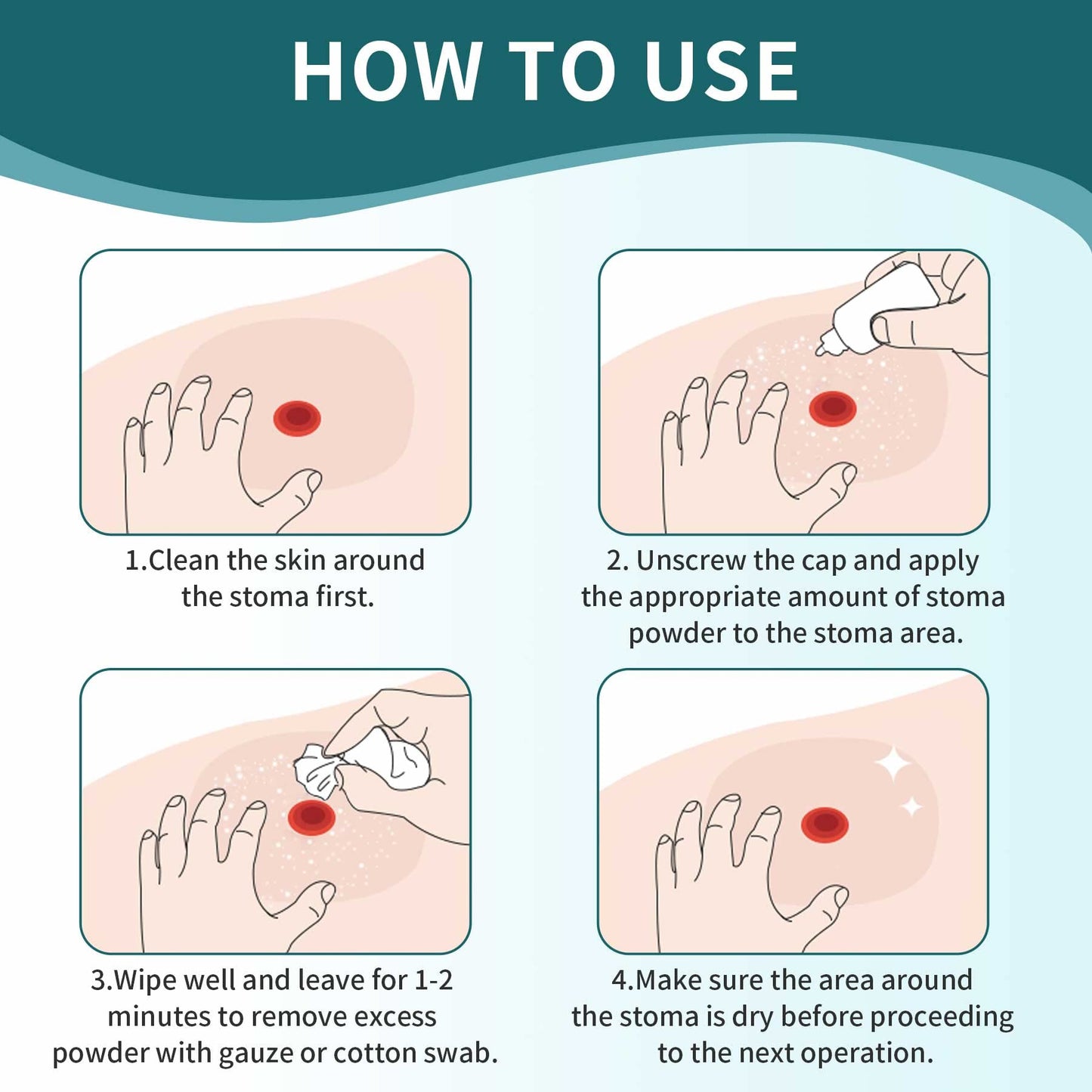 ovand Stoma Powder,Skin Barrier Protection Ostomy Powder Supplies - Stoma Adhesive Powder,1 oz (2 Bottles)