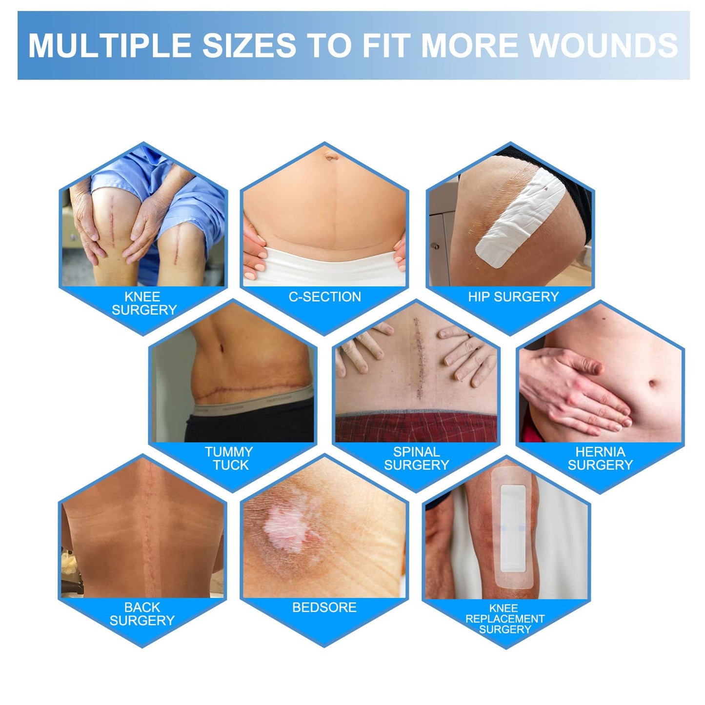 30 Pack 4"x14" Waterproof Adhesive Island Dressing for Post-Surgery Recovery | Sterile Bordered Gauze Bandages with Non-Stick Pad for Knee/Hip Replacement, Surgical Incision Care & Shower Protection