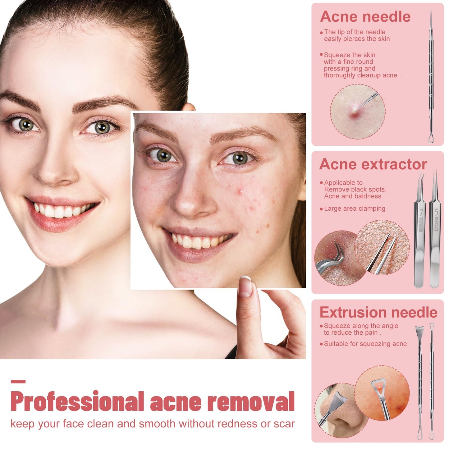 JPNK Black Acne Extractor Tool, Professional Stainless Pimple Acne Blemish Removal Tools Set with Mirror
