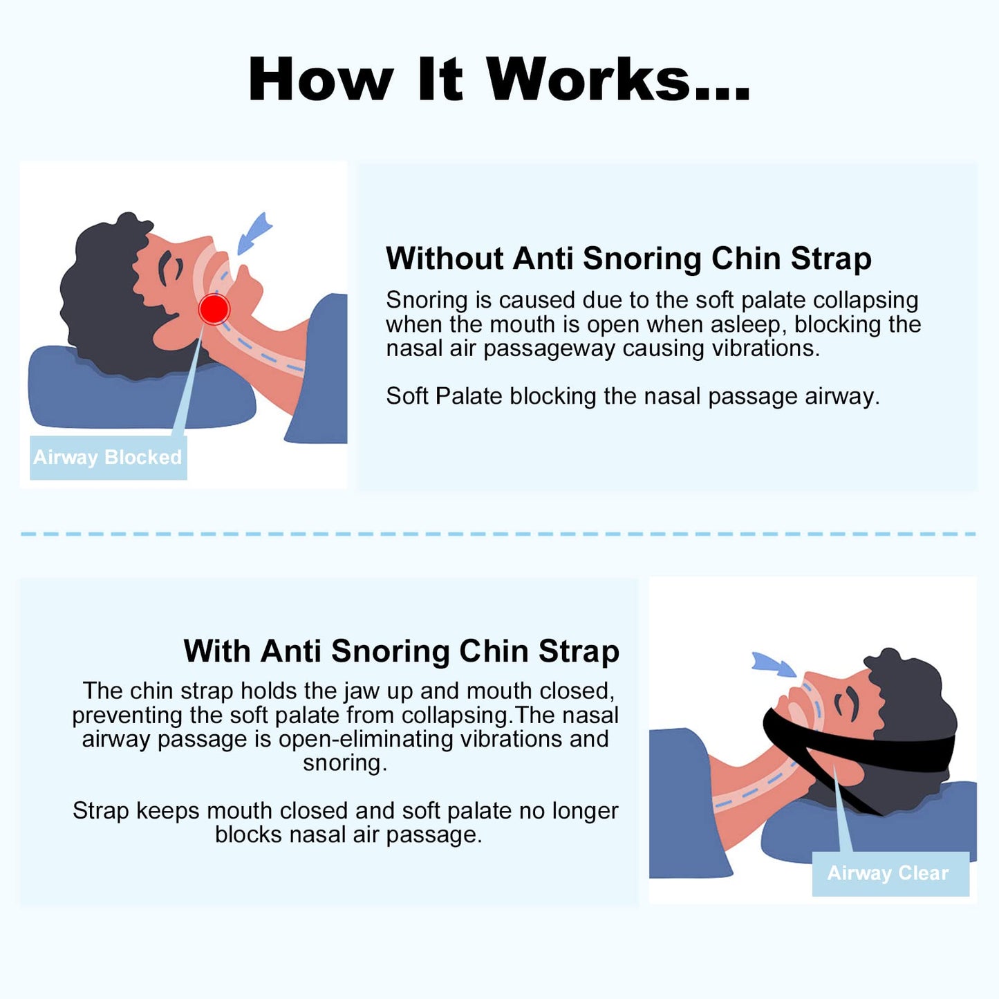 Anti-Snore Chin Strap Devices, Chin Strap for Sleeping Comfortable Snoring Solution, Breathable and Adjustable for Men and Women - Black11