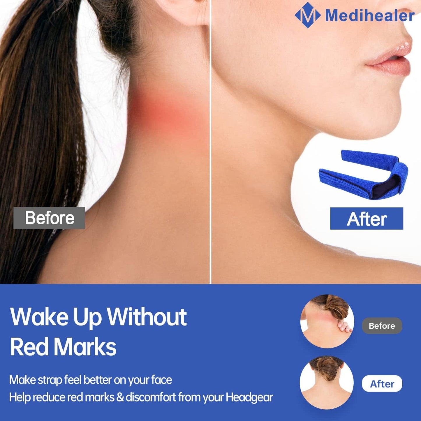 2Packs Replacement Headgear for Airfit N20 with Neck Pads and 2 Pair Clips, Headgear Compatible with Airfit N20, Comfort Neck Pad Headgear Strap Cover, Great Value Kit Supplies by Medihealer