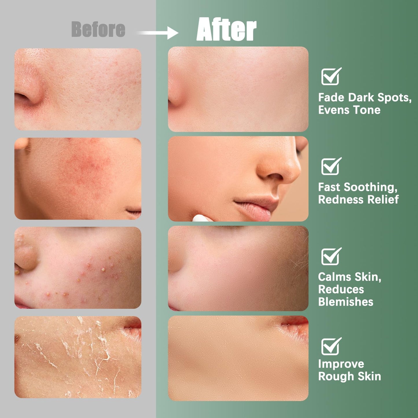 Kestper Madecassoside Toner Pads | 110 Pad Calming Face Pads with Centella Asiatica to Soothe,Balance Skin Tone,Fades Blemishes