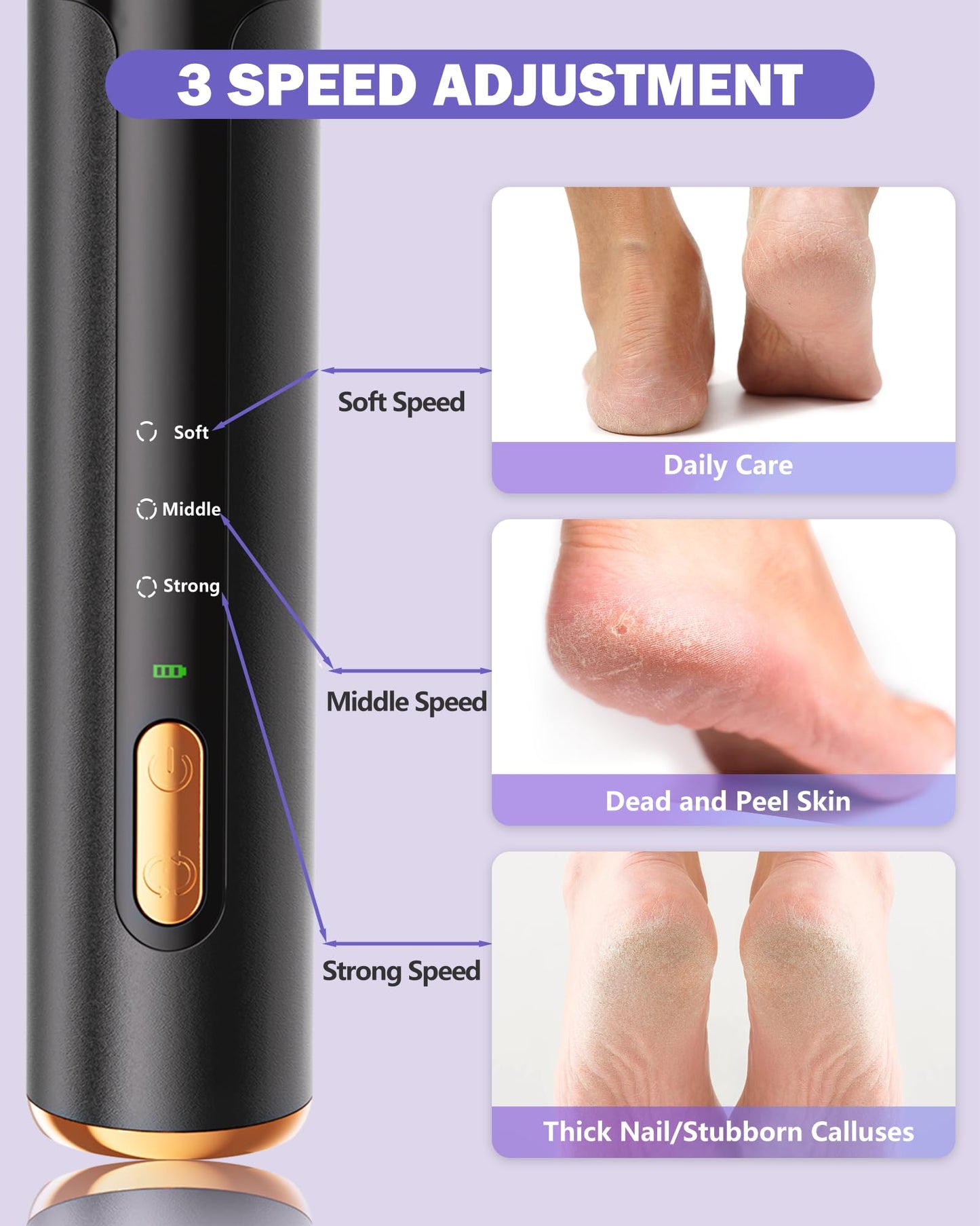 AvantShine Electric Foot Callus Remover, Callus Remover for Feet with 60 Pcs Sandpaper Discs, Rechargeable & Adjustable Speeds L