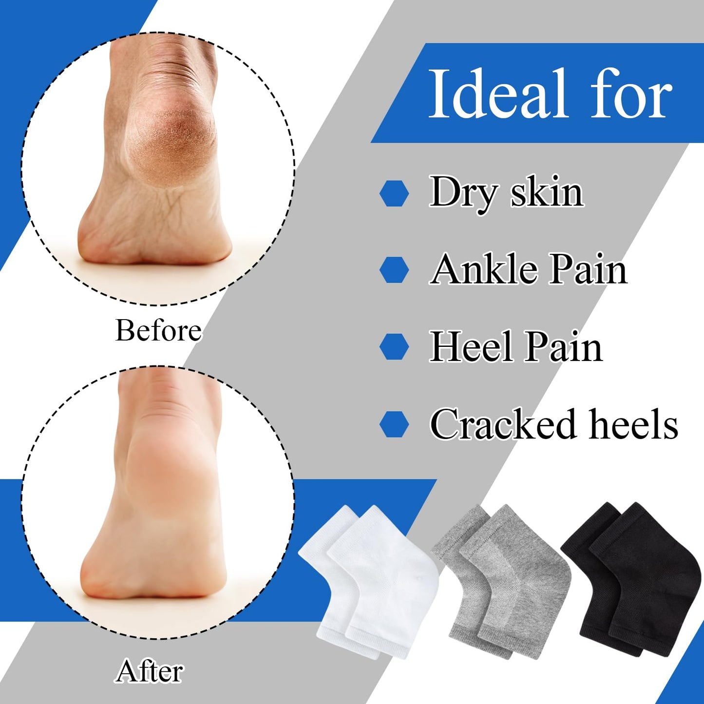 Moisturizing Socks,toeless Socks for Women for Dry Cracked Heel Treatment,Cracked Heel,msilicone Socks for Women (One Size-3 Pai