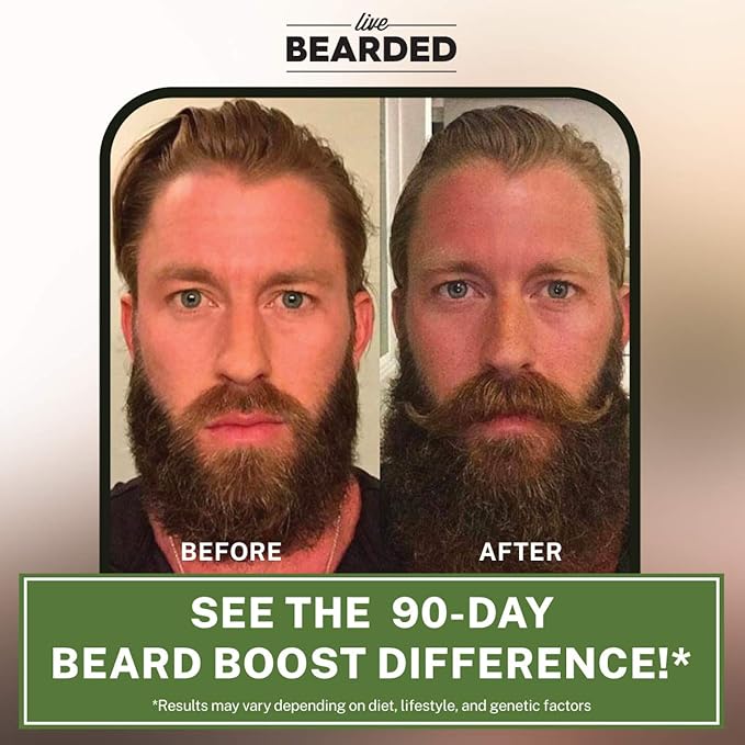 Live Bearded Beard Boost - Hair Growth Multivitamins with Biotin 10,000mcg, Vitamins C, E and Zinc - Thick, Strong, Full Grow Support - Made in The USA | 30-Day Supply