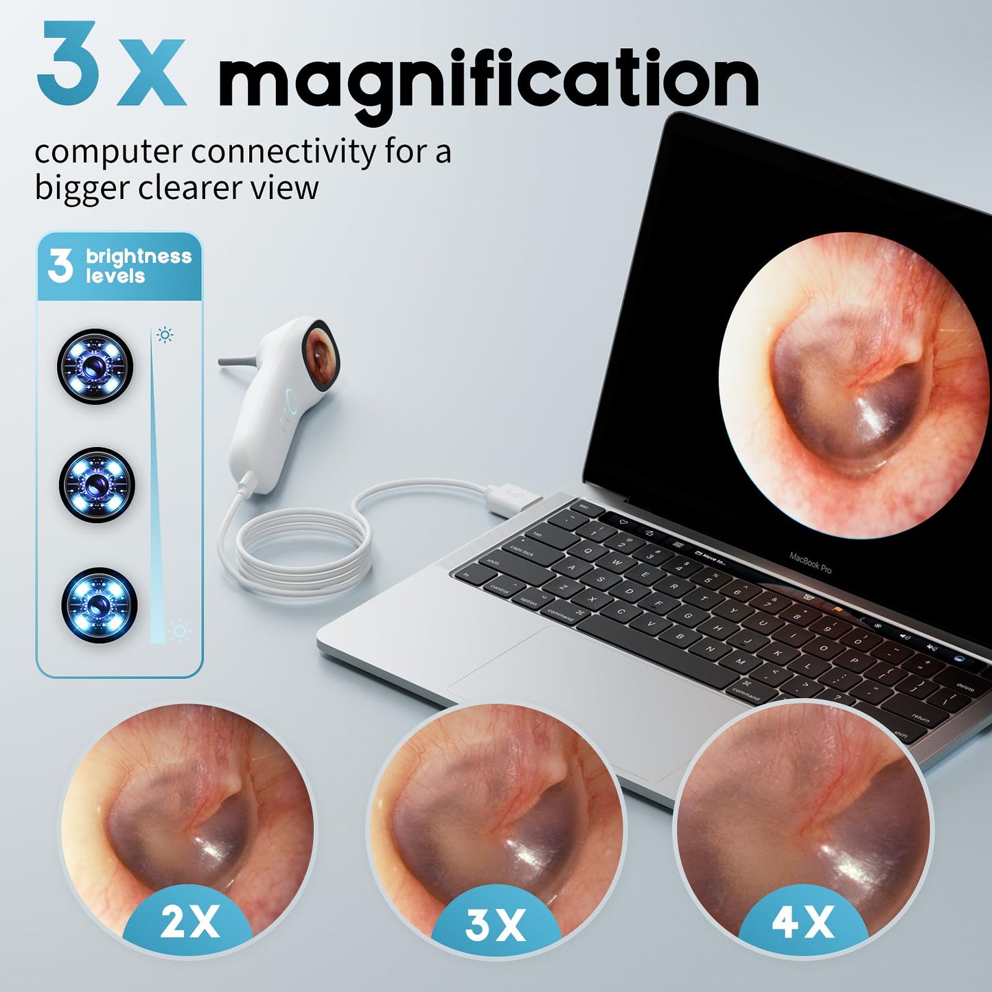 Otoscope Ear Camera with 1.21” Screen, 1080P Ear Scope with 4 LED Lights, Otoscope Camera for Adults Kids and Pets, Support Photo & Video, Type-C Charging with Computers, Baby Essentials, Home Medical