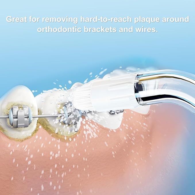 Replacement Tips for Waterpik Water Flosser, Replacement Orthodontic Tips Compatible with Waterpik Water Flossers and Other Brand Oral Irrigators (6 Orthodontic Tips)
