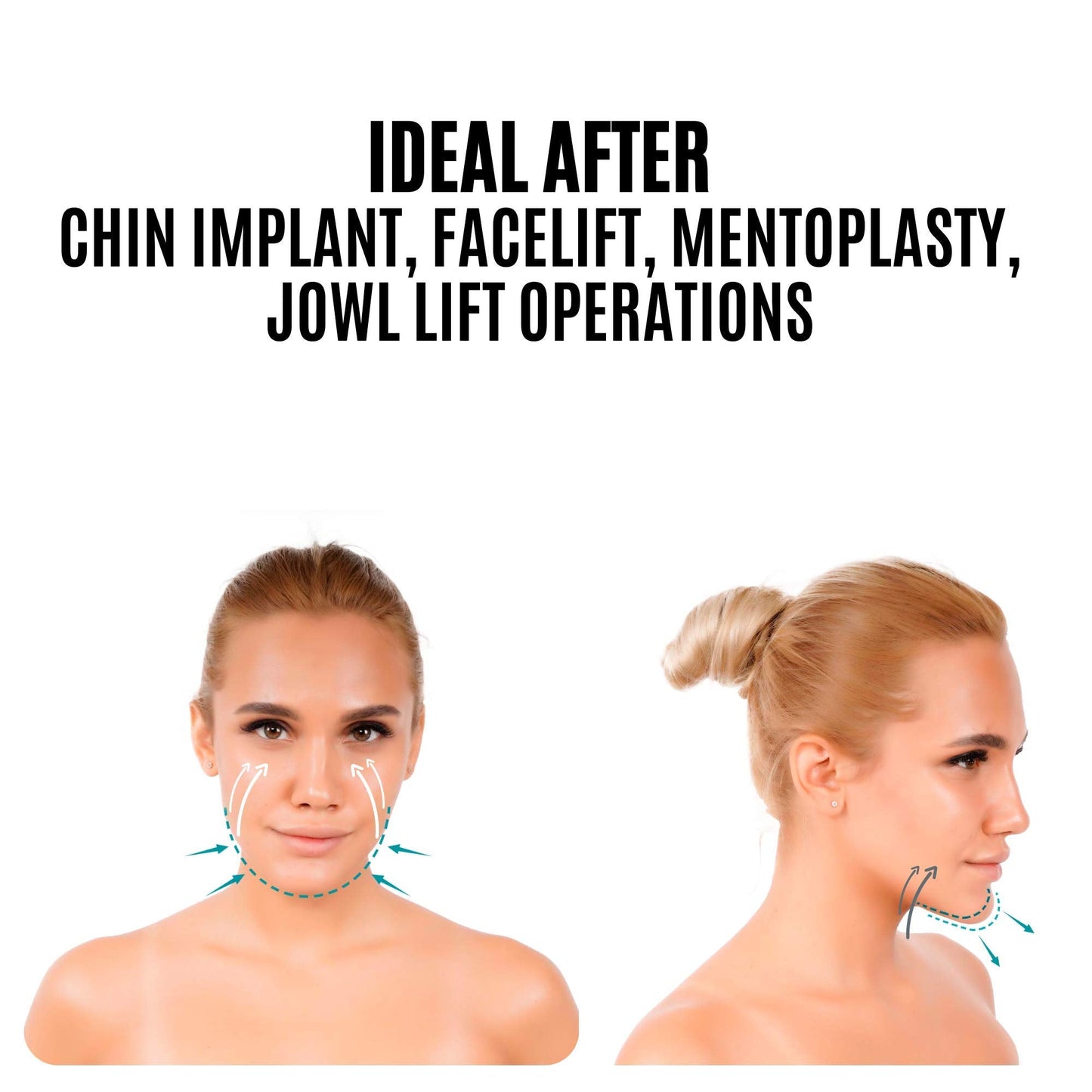 invera Chin Compression Garment After Liposuction Surgery, Neck Cover Strap Bandage