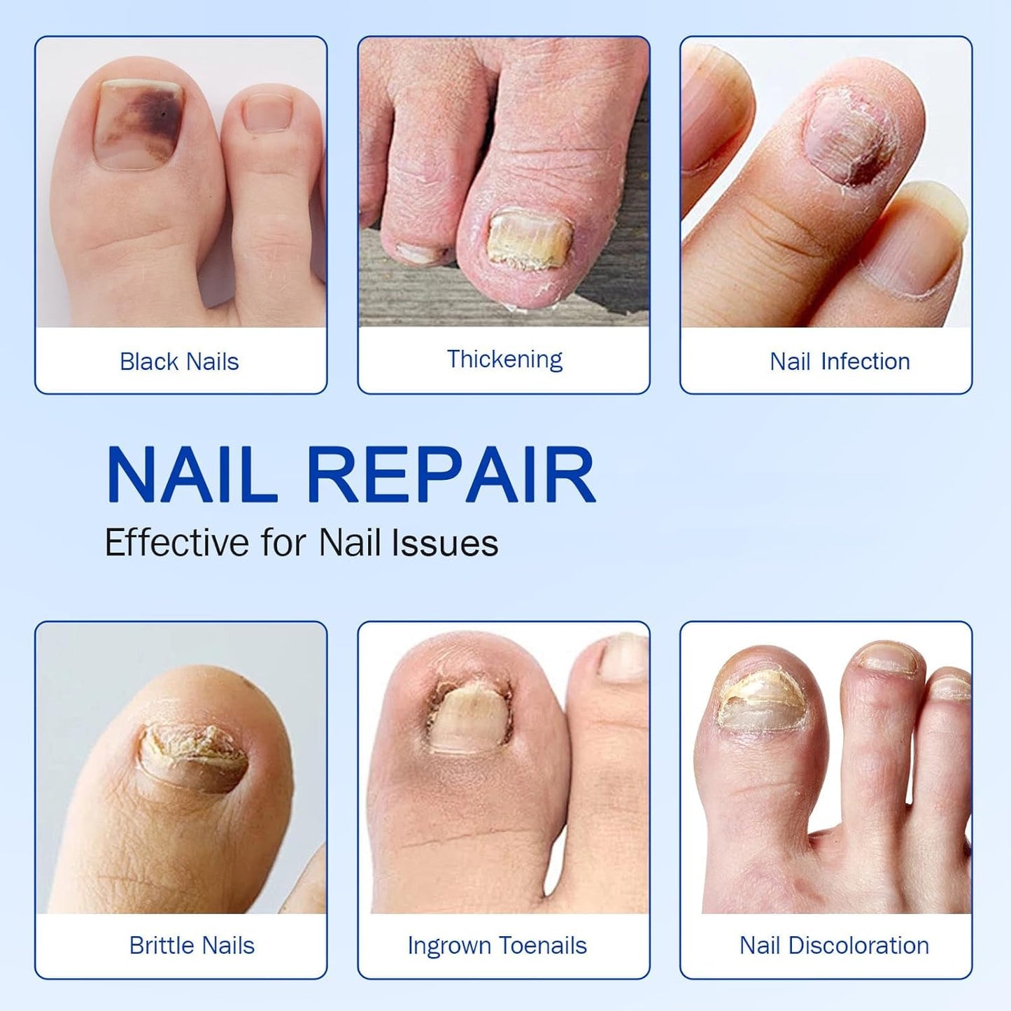 Fungal Nail Patches, Nail patches for toenails, Overnight Toe Nails Treatments for Damaged Foot Nails Repair and Care, Safe for